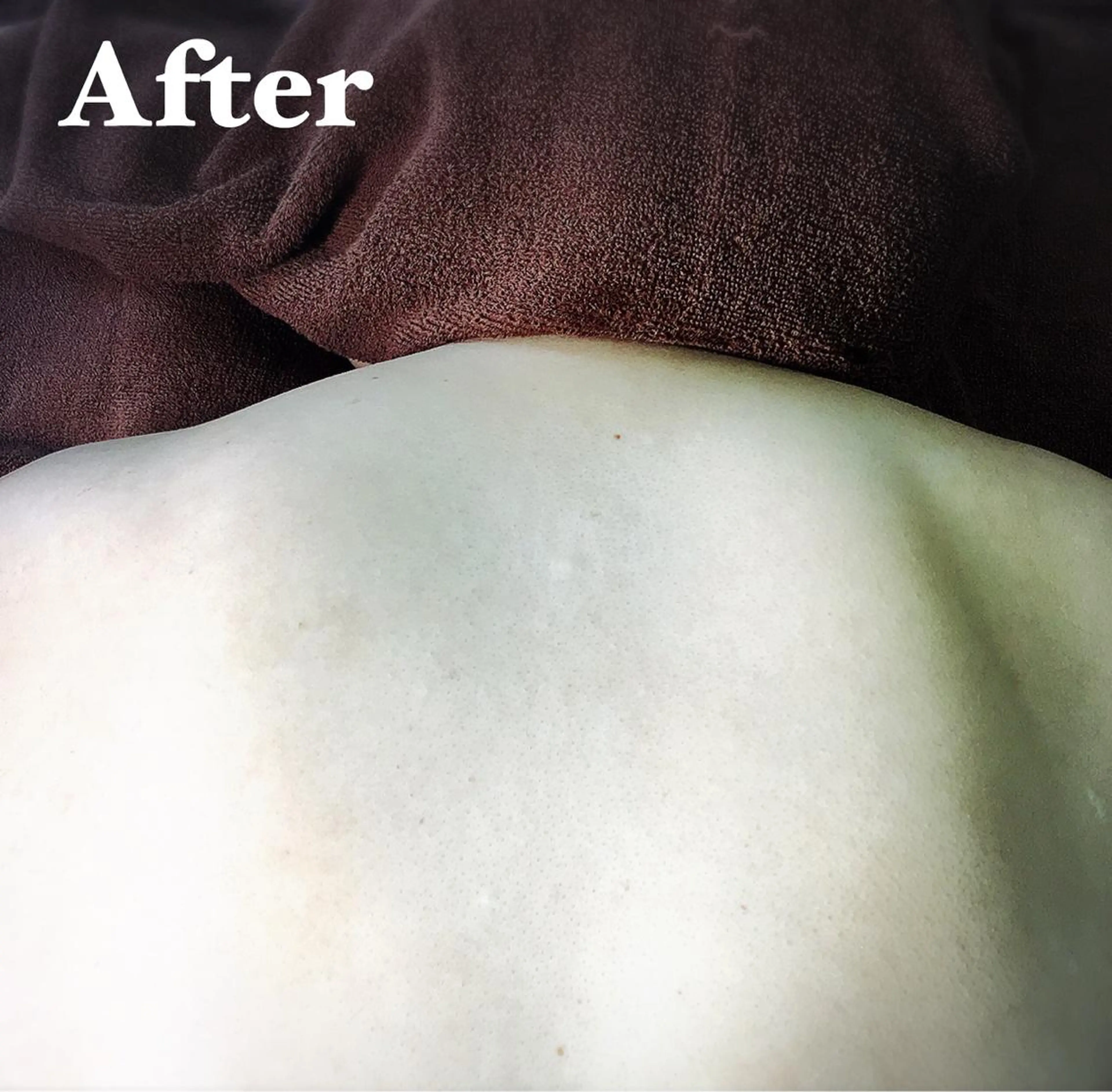 MIMI 吉祥寺本店のエステ・リラクイメージ