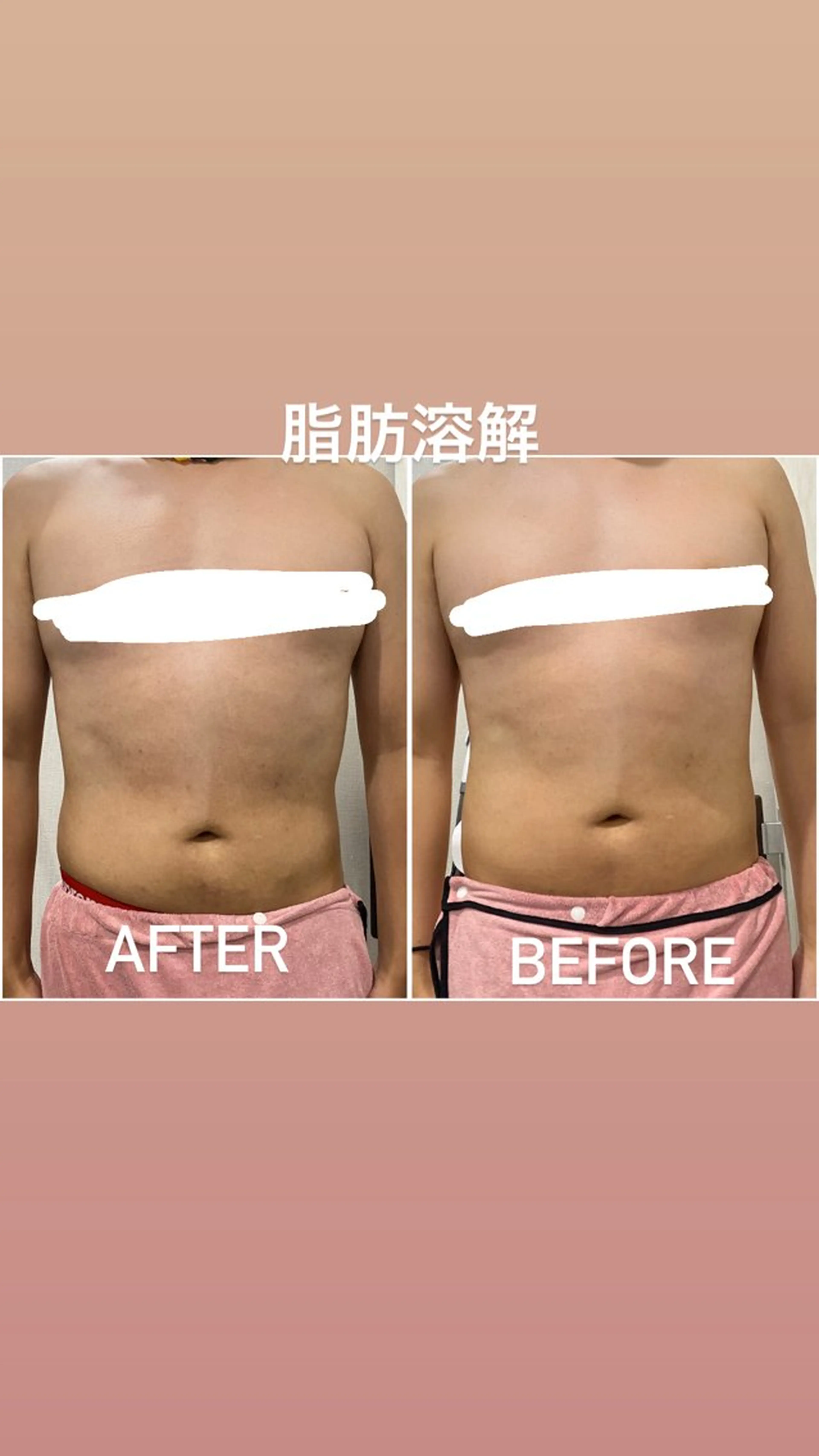 エステ 毛穴洗浄・痩身・脱毛 /アルカンジュのエステ・リラクイメージ