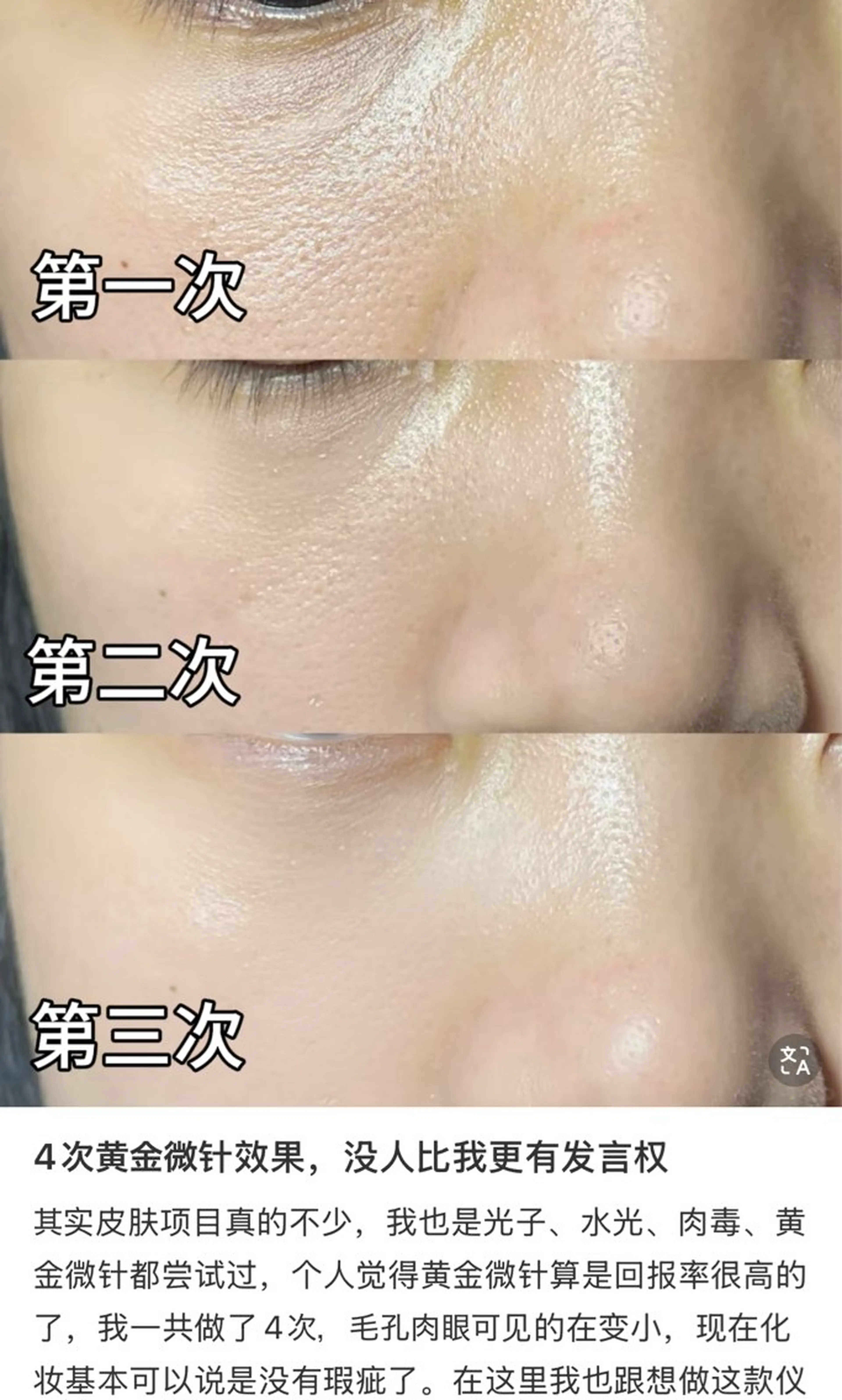 マツエク・マツパ エステ リラク 愛維美水光美肌専門店所属・愛維美水光美肌専門店 メンズレディースokのエステ・リラクイメージ