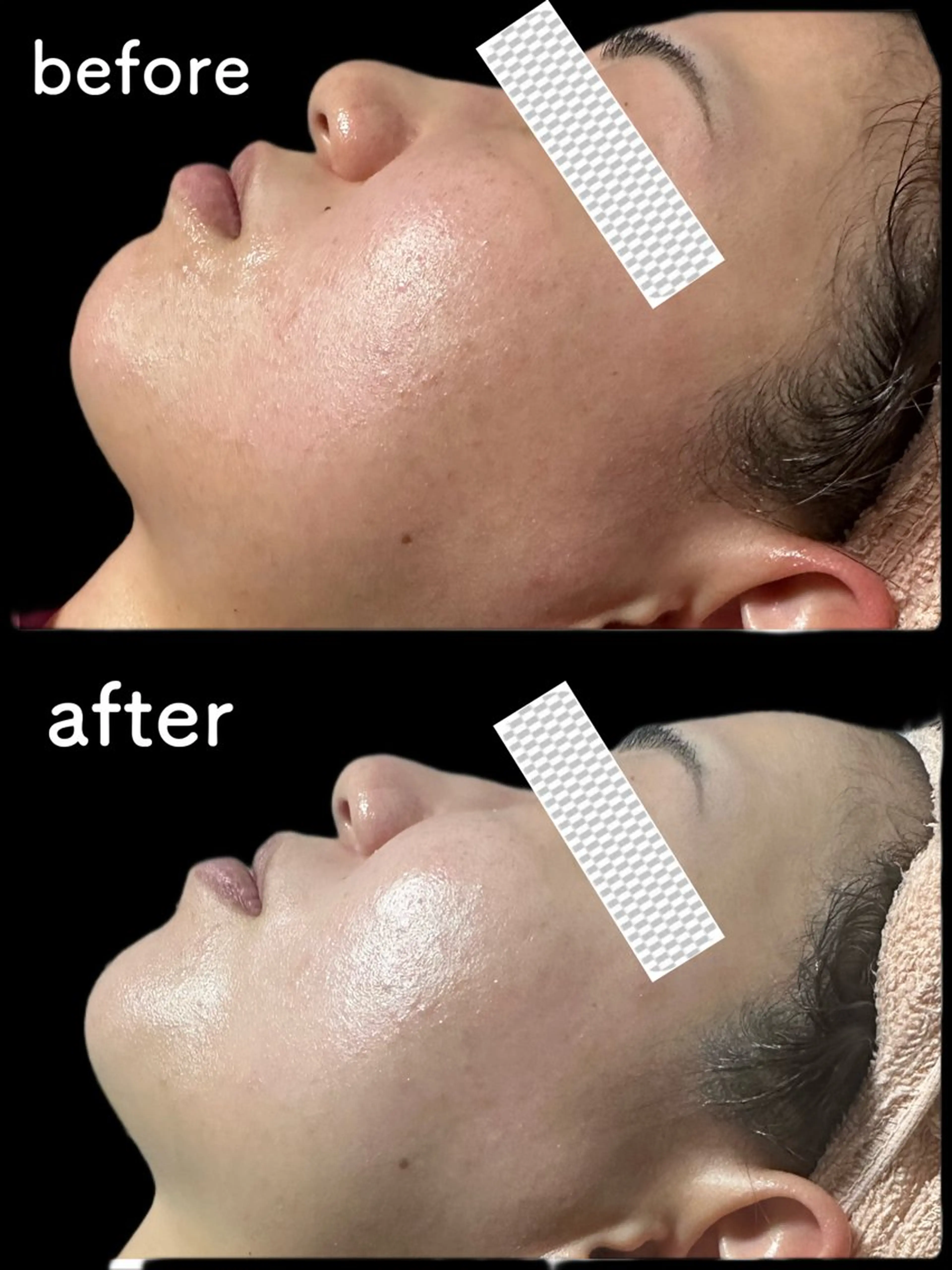 marron所属・痩身ハイパーナイフ ララピールリアボーテのエステ・リラクイメージ