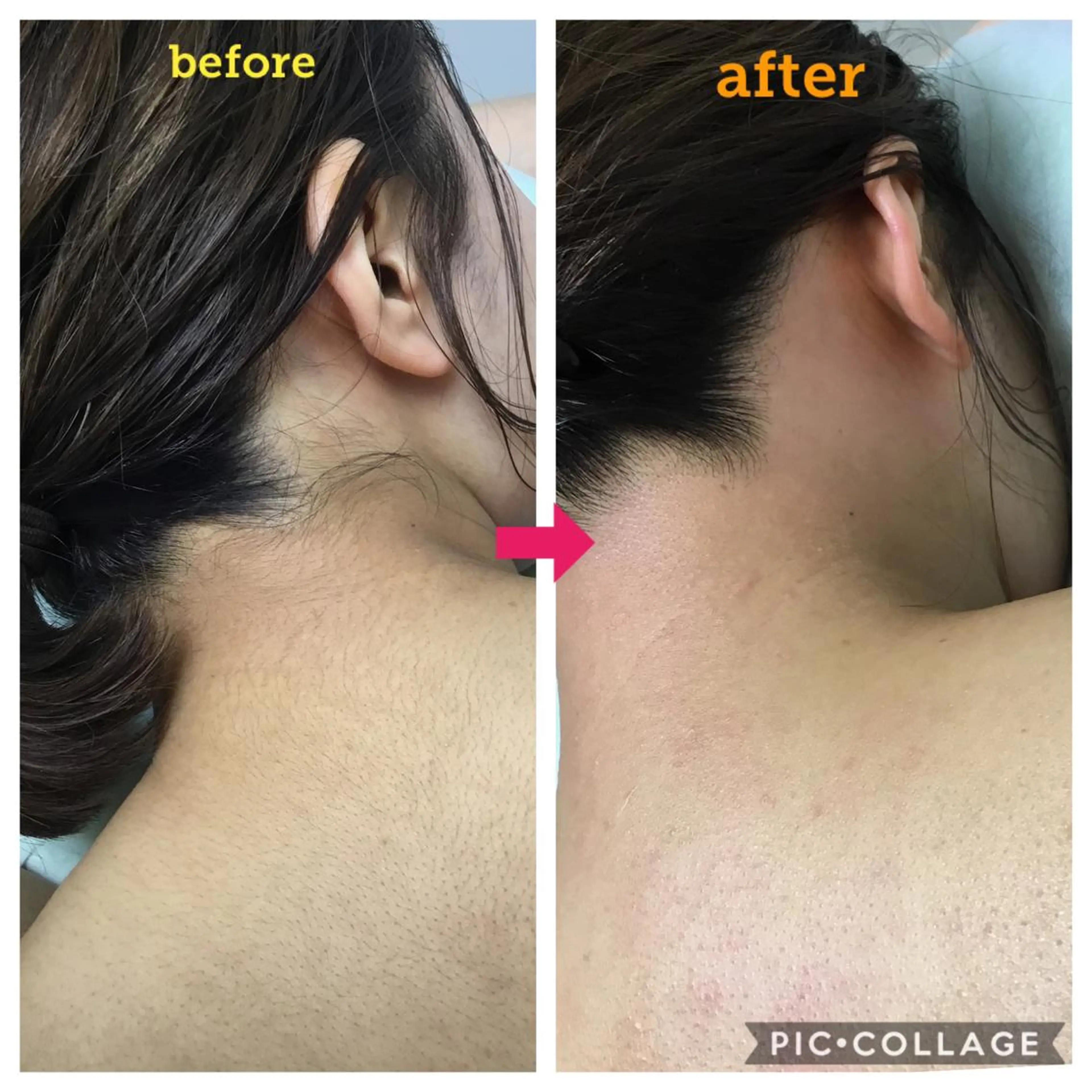 毛穴レス ハーブ＆ ワックス脱毛×光脱毛のエステ・リラクイメージ