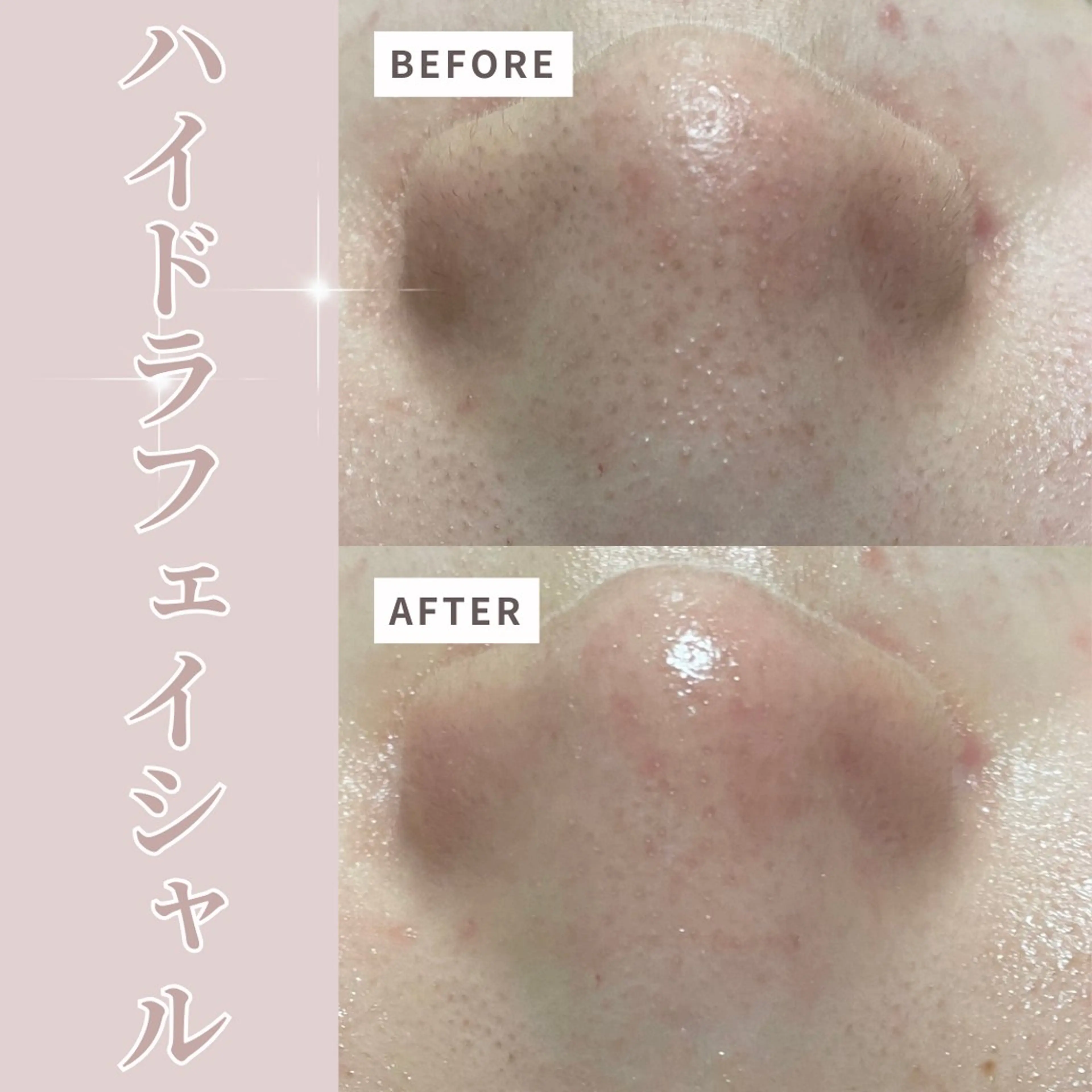 エステ リラク プライベートサロン Belle（ベル）のエステ・リラクイメージ