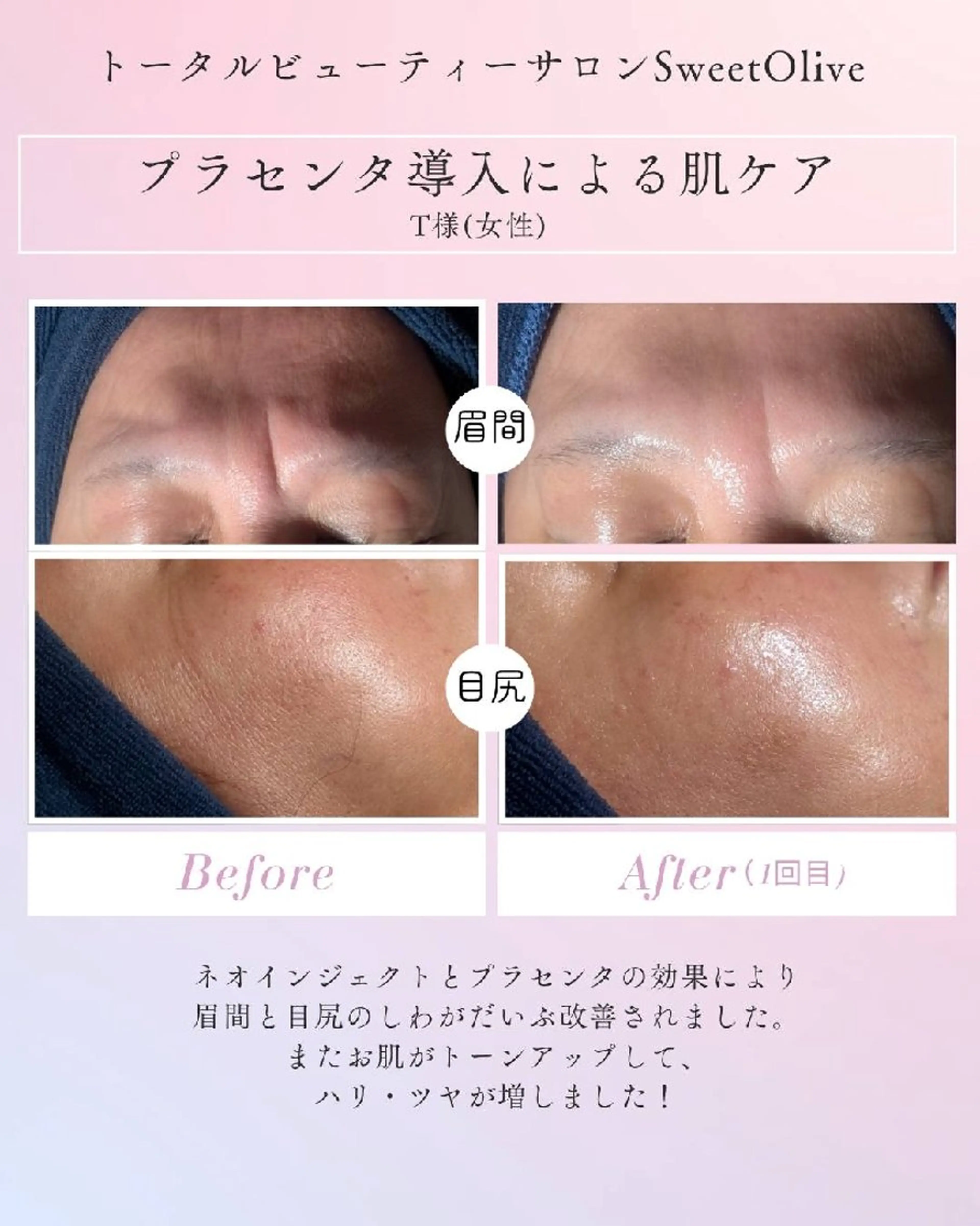 エステ SweetOlive 　 Akaneのエステ・リラクイメージ