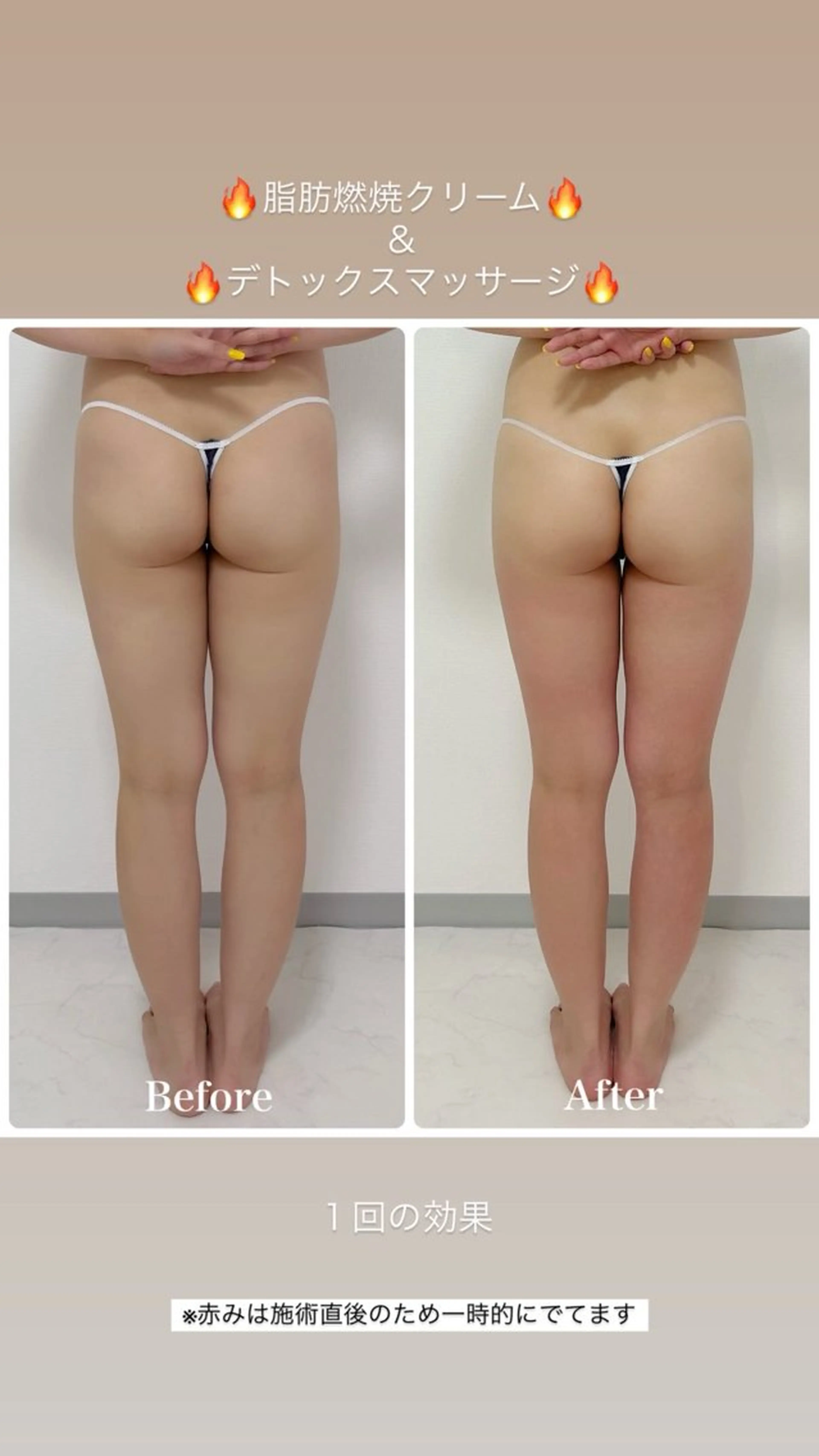 エステ Liam《美肌管理/ 3D小顔/脂肪ケア》のエステ・リラクイメージ