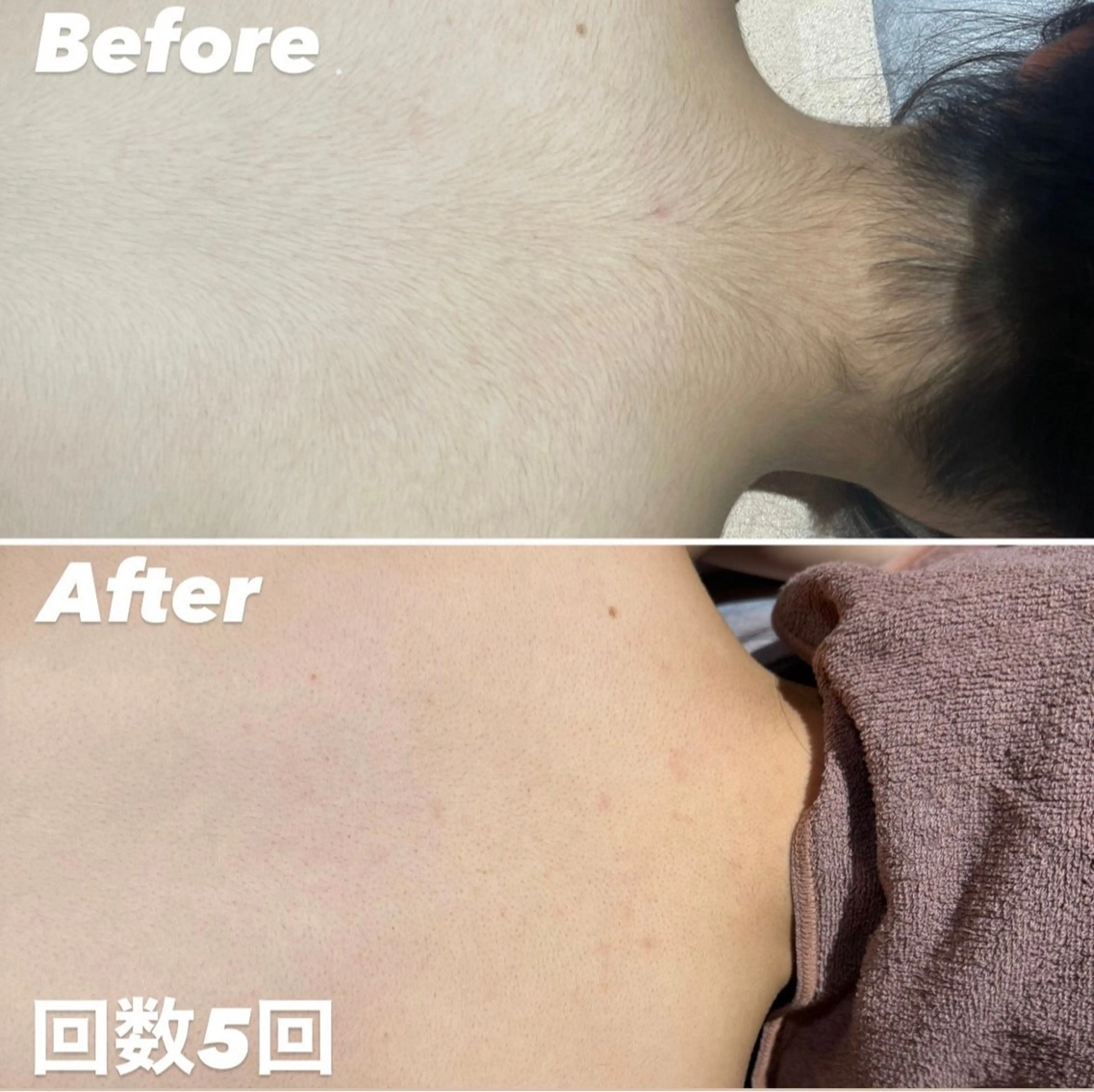 R-four🦋 土屋のエステ・リラクイメージ