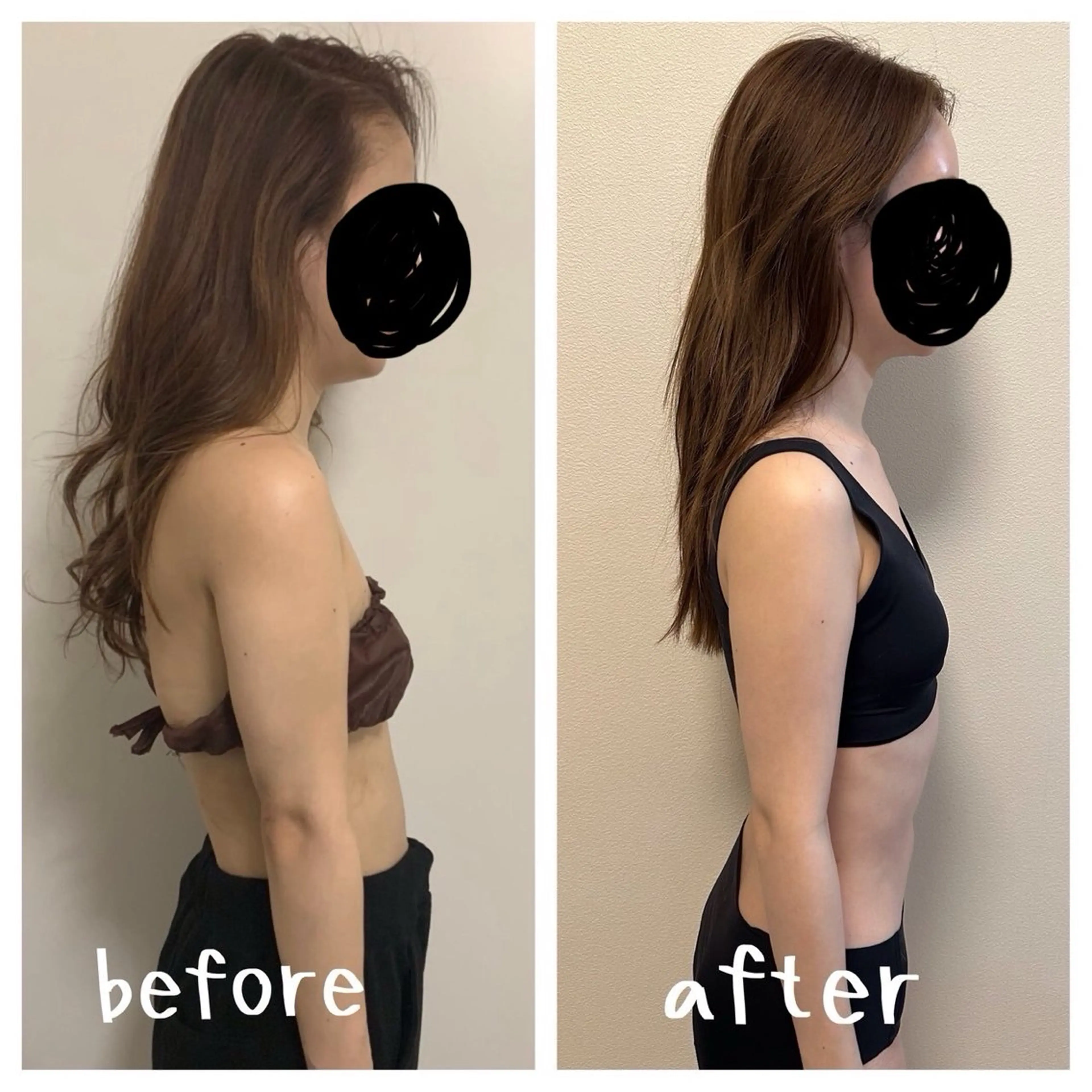 その他 医療提携×美容整体 小顔ハイフピーリングのエステ・リラクイメージ