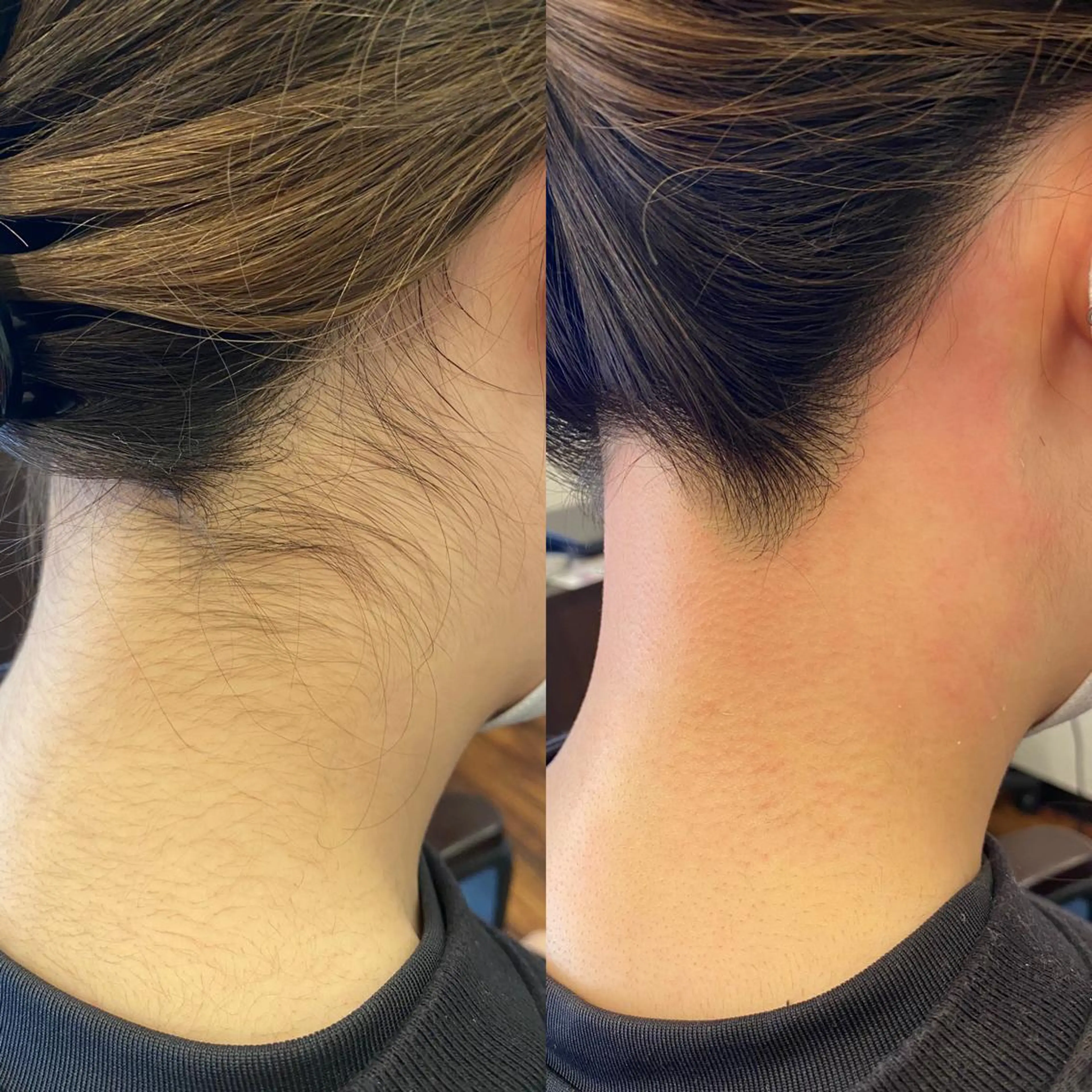 脱毛 salon kannaのヘアスタイル