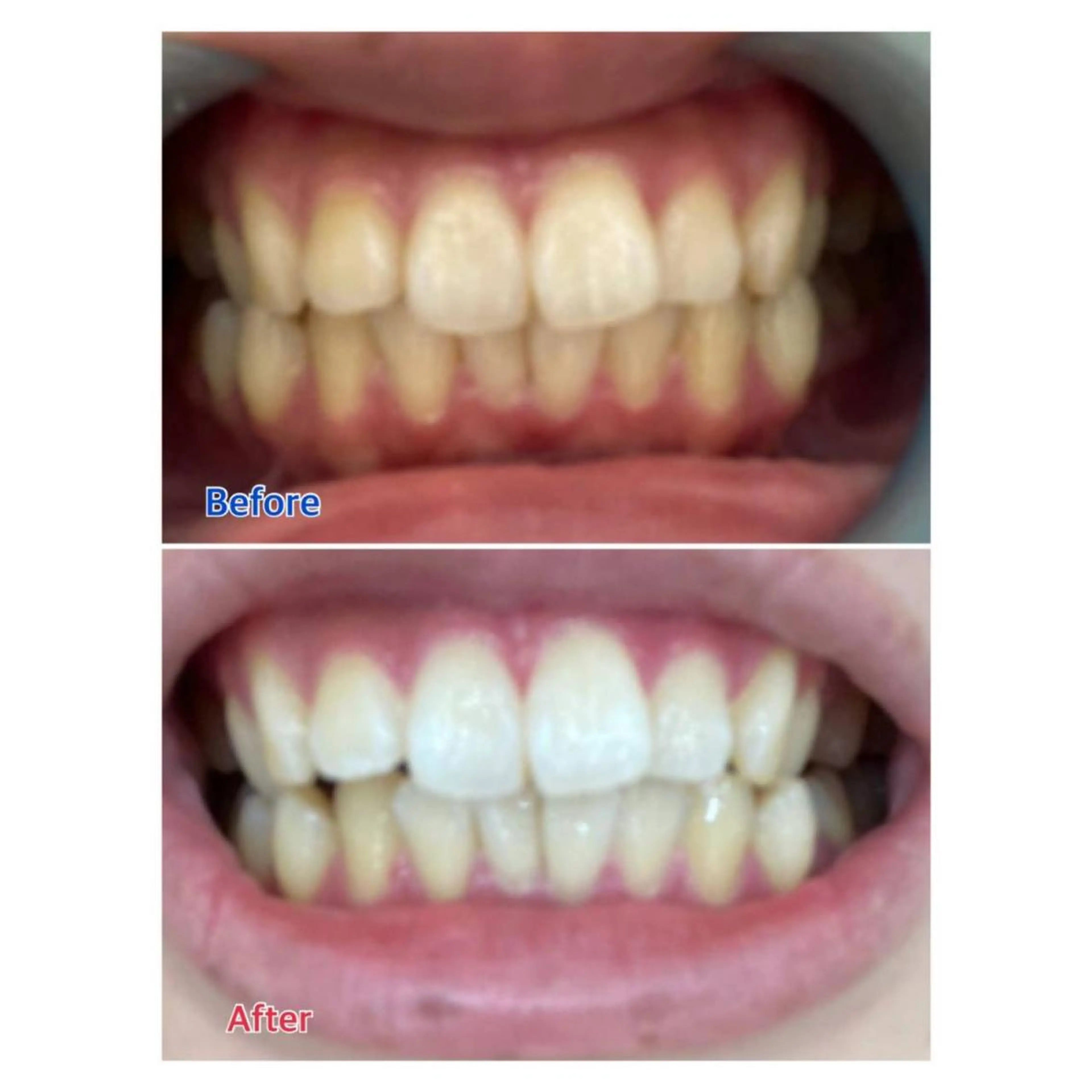 MBEAUTYSALON 千葉店・京成大久保所属・Melty 輝のその他イメージ