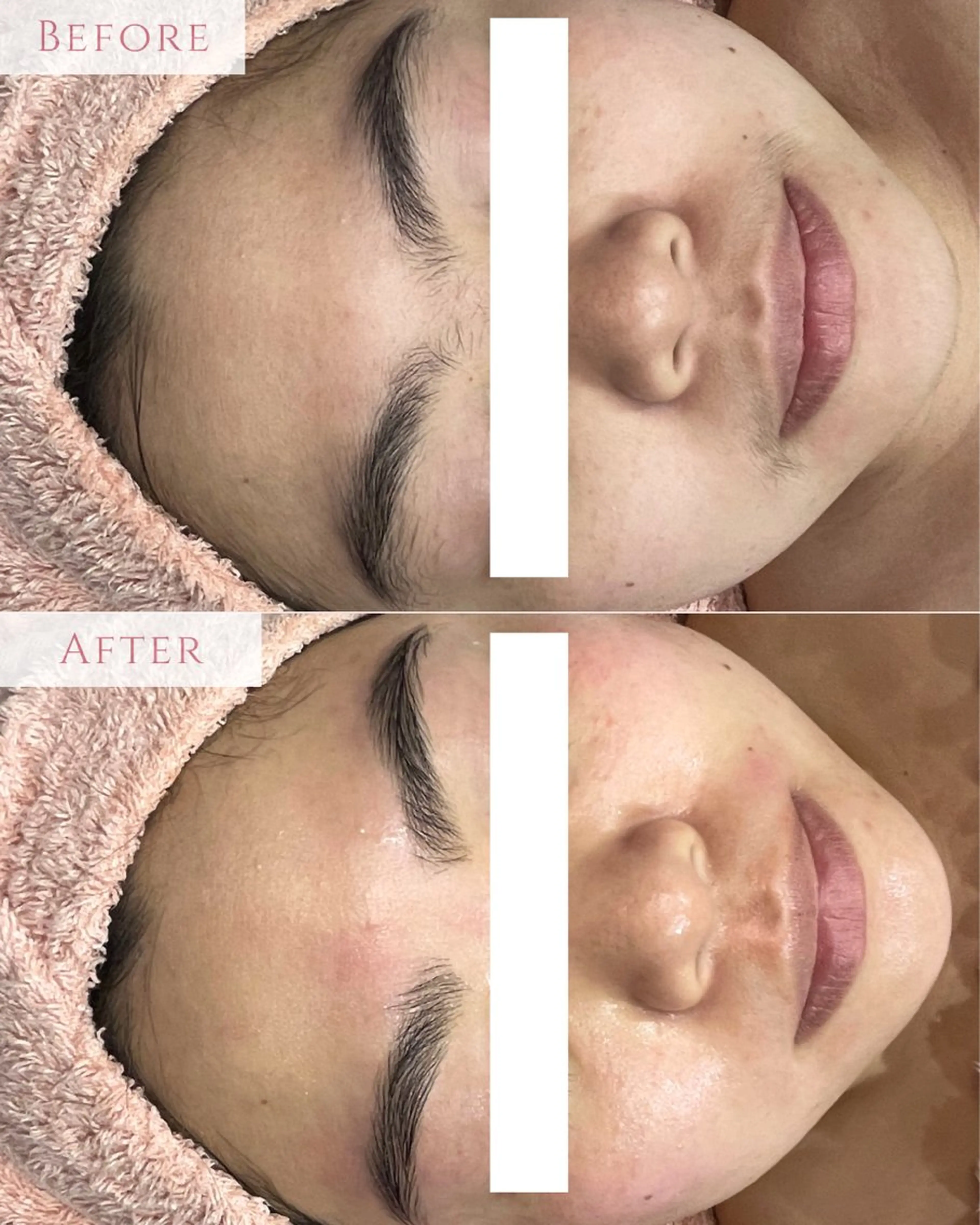 脱毛 肌質改善専門サロン Bellmi/心斎橋のエステ・リラクイメージ