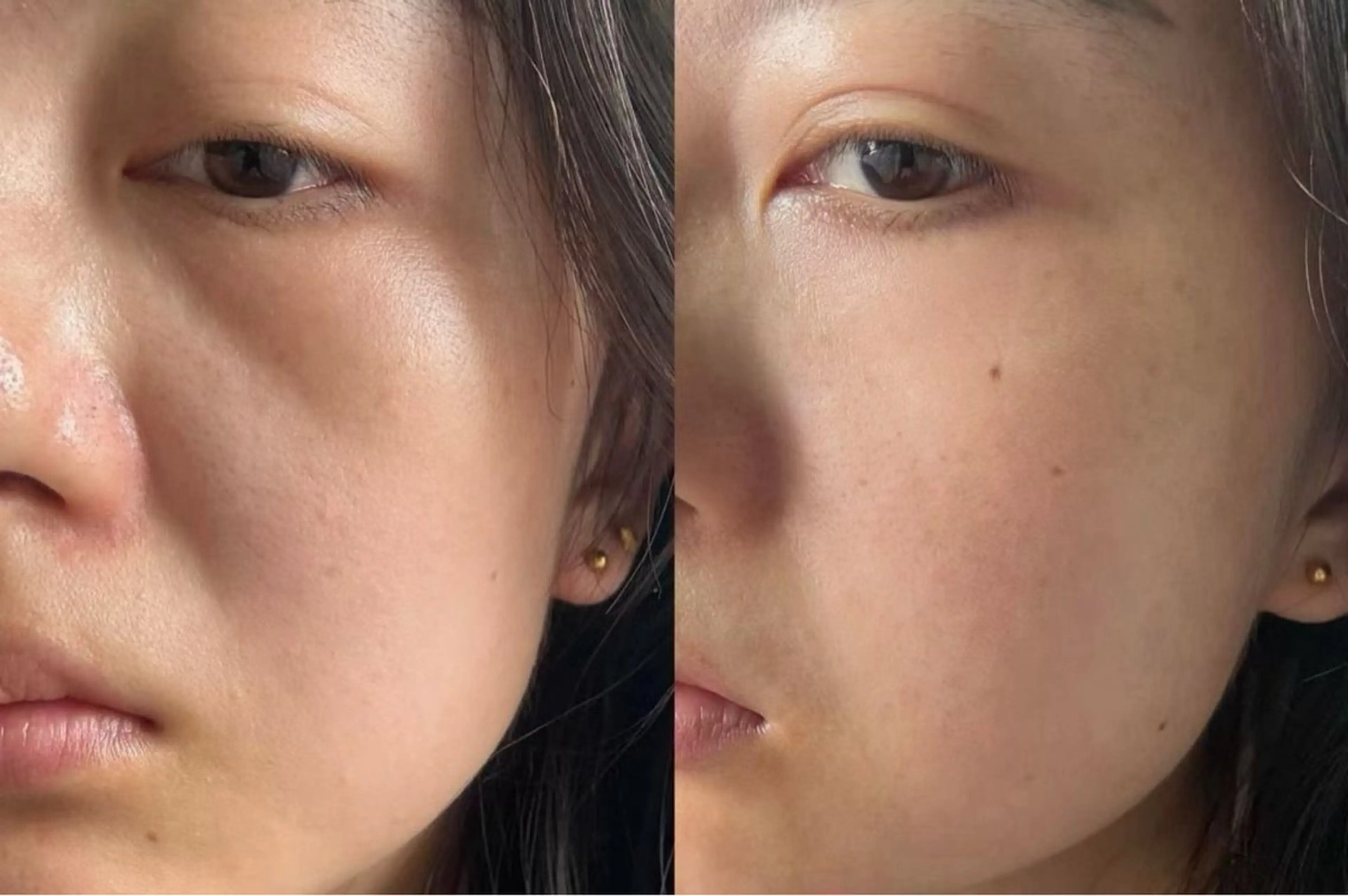 ネイル エステ aliaハイフ&水光ジェットサロン所属・aliaハーブ水光店 エステティシャン募集のエステ・リラクイメージ