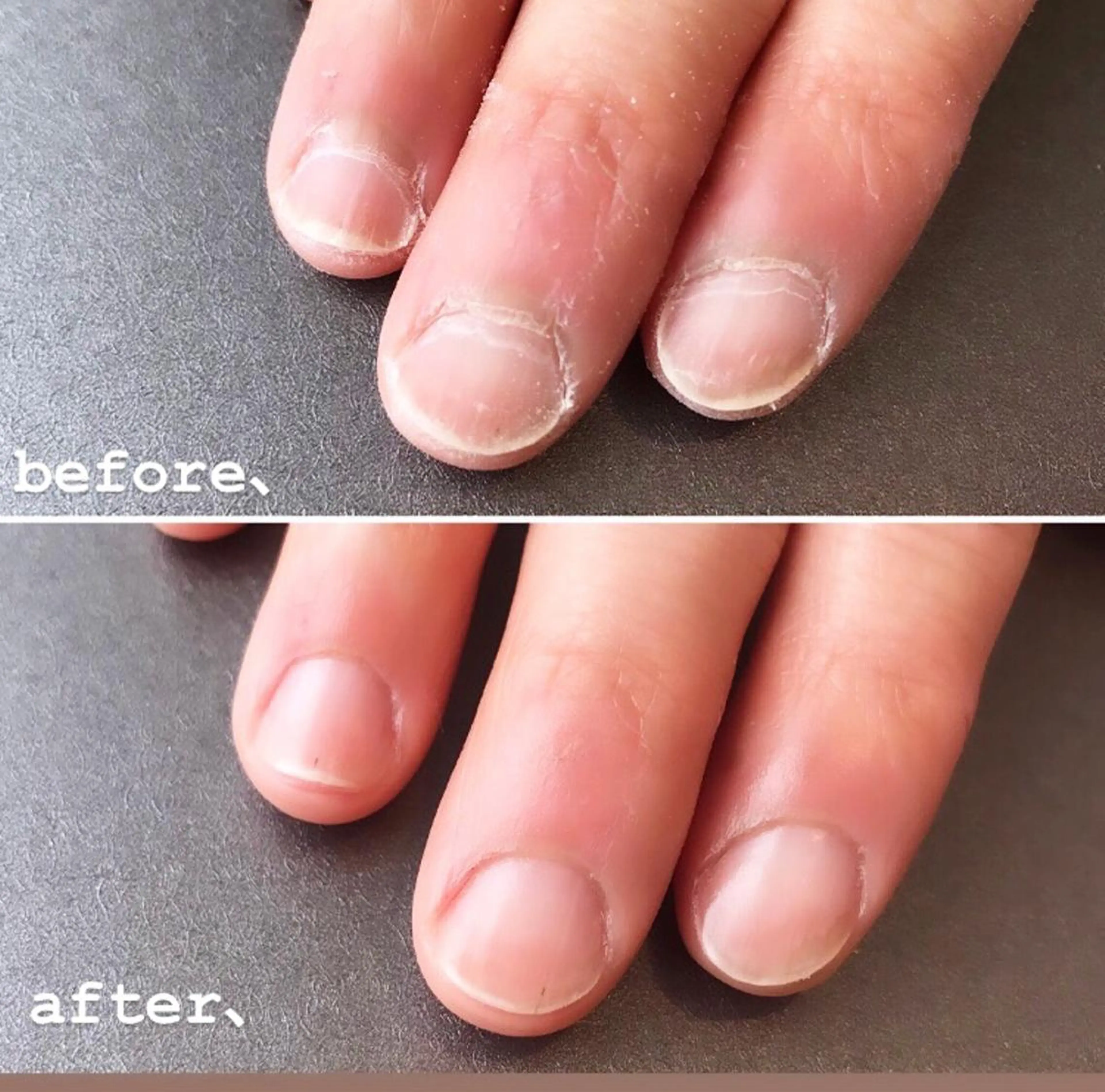 (新規様)ネイルケアコースの写真