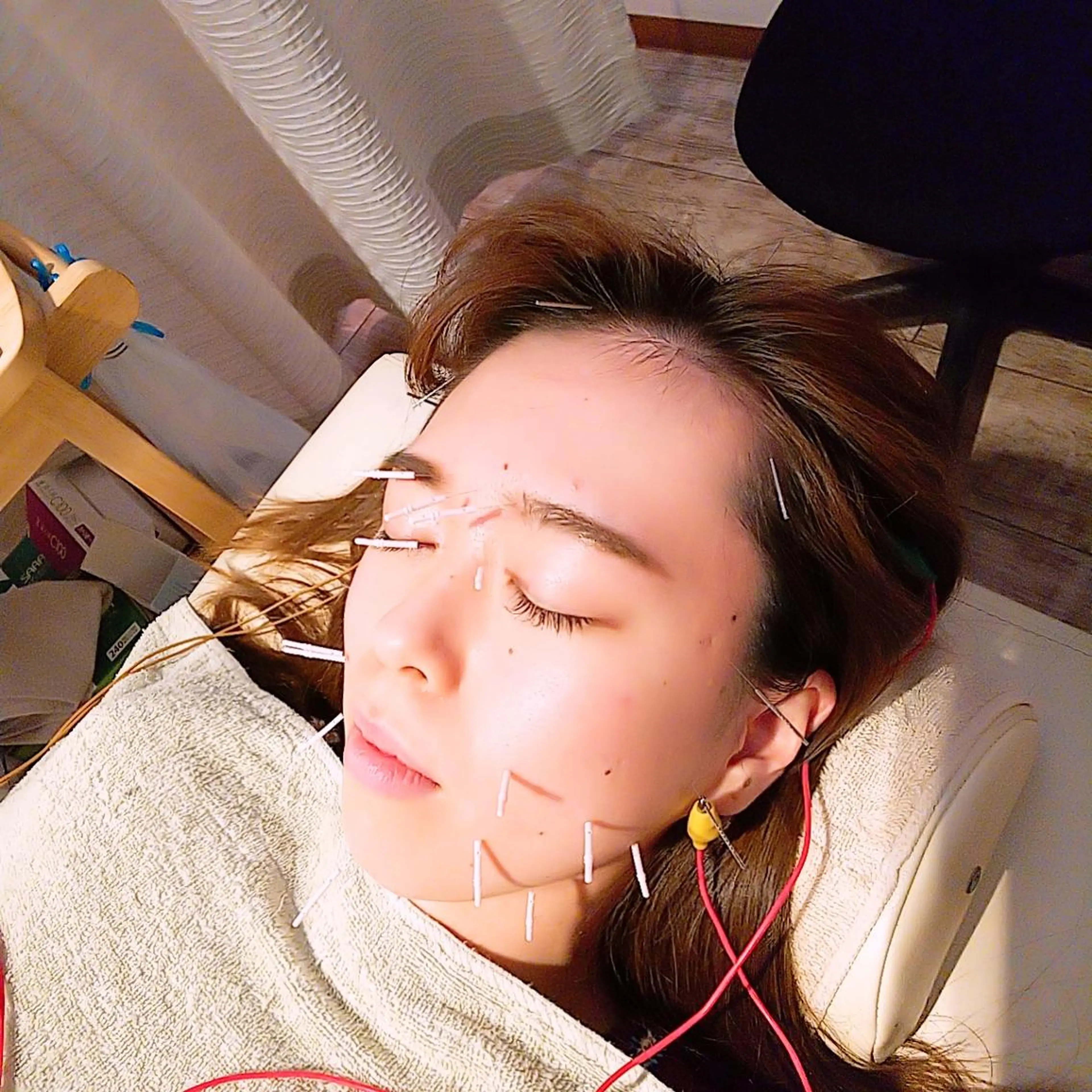 むくみたるみ専門☆ 美容鍼・小顔矯正のエステ・リラクイメージ