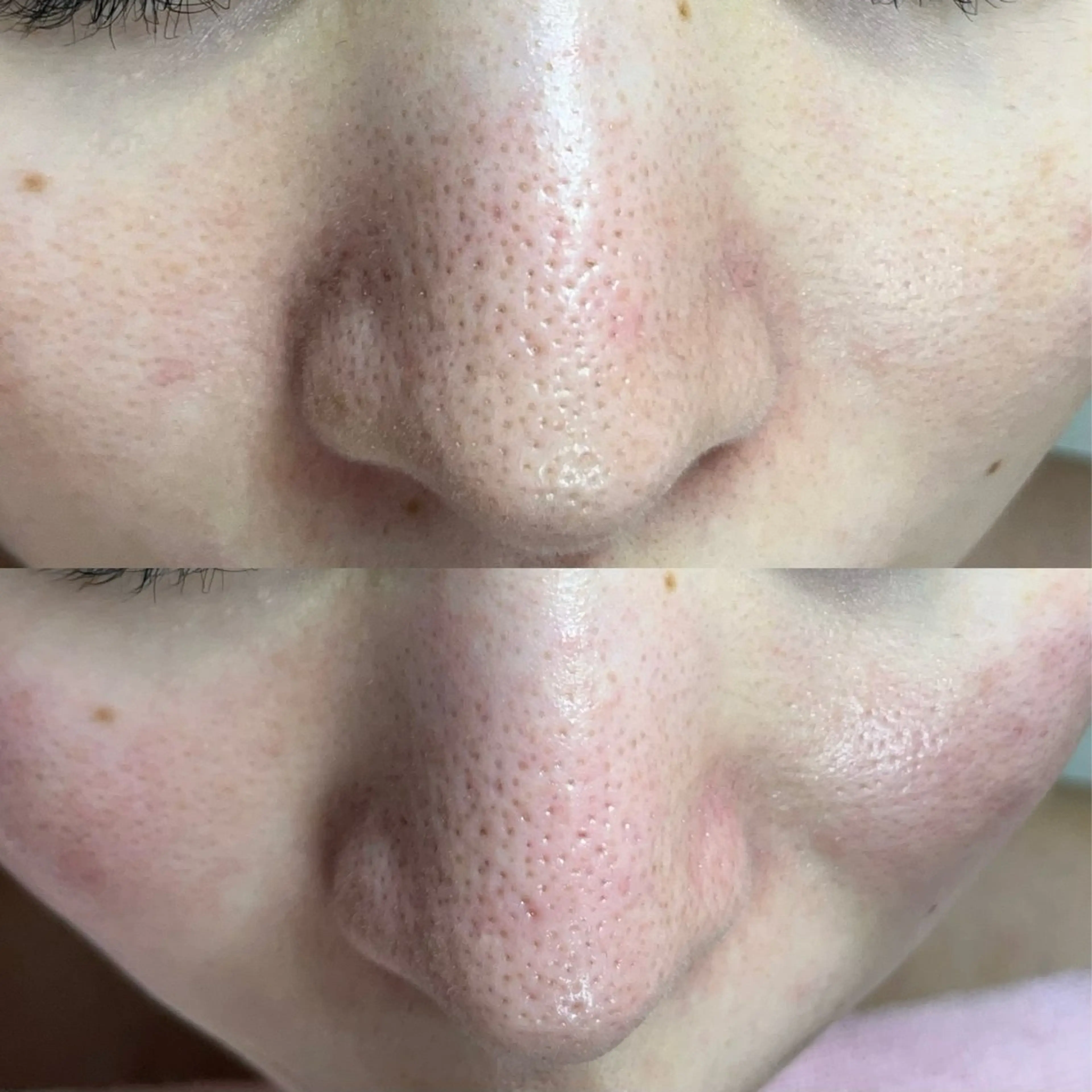 毛穴ケア・ヘッドスパサロンSHINY(シャイニー)所属・毛穴ケア・ヘッドスパ サロンSHINYのエステ・リラクイメージ