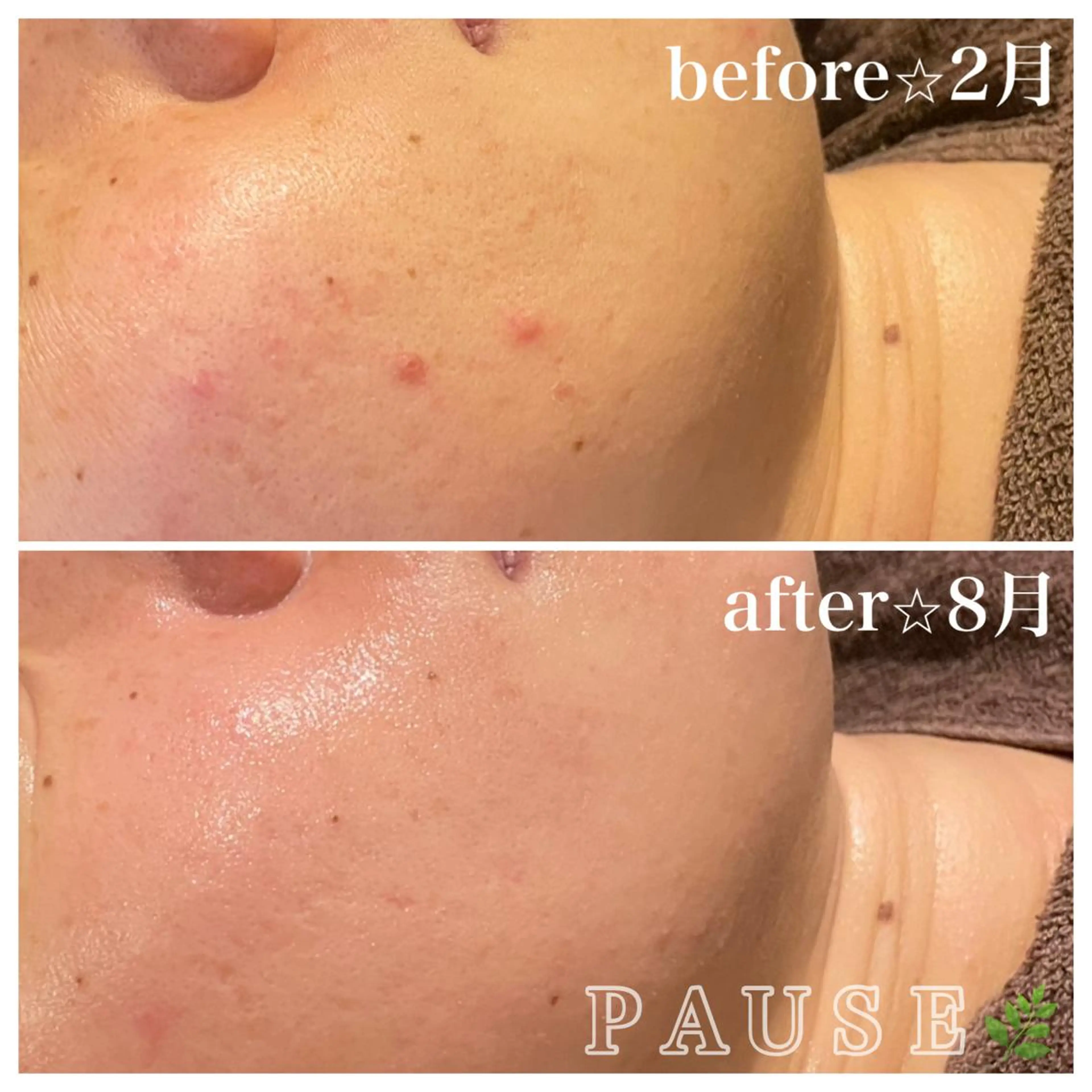 エステ 浜野 恵美のエステ・リラクイメージ