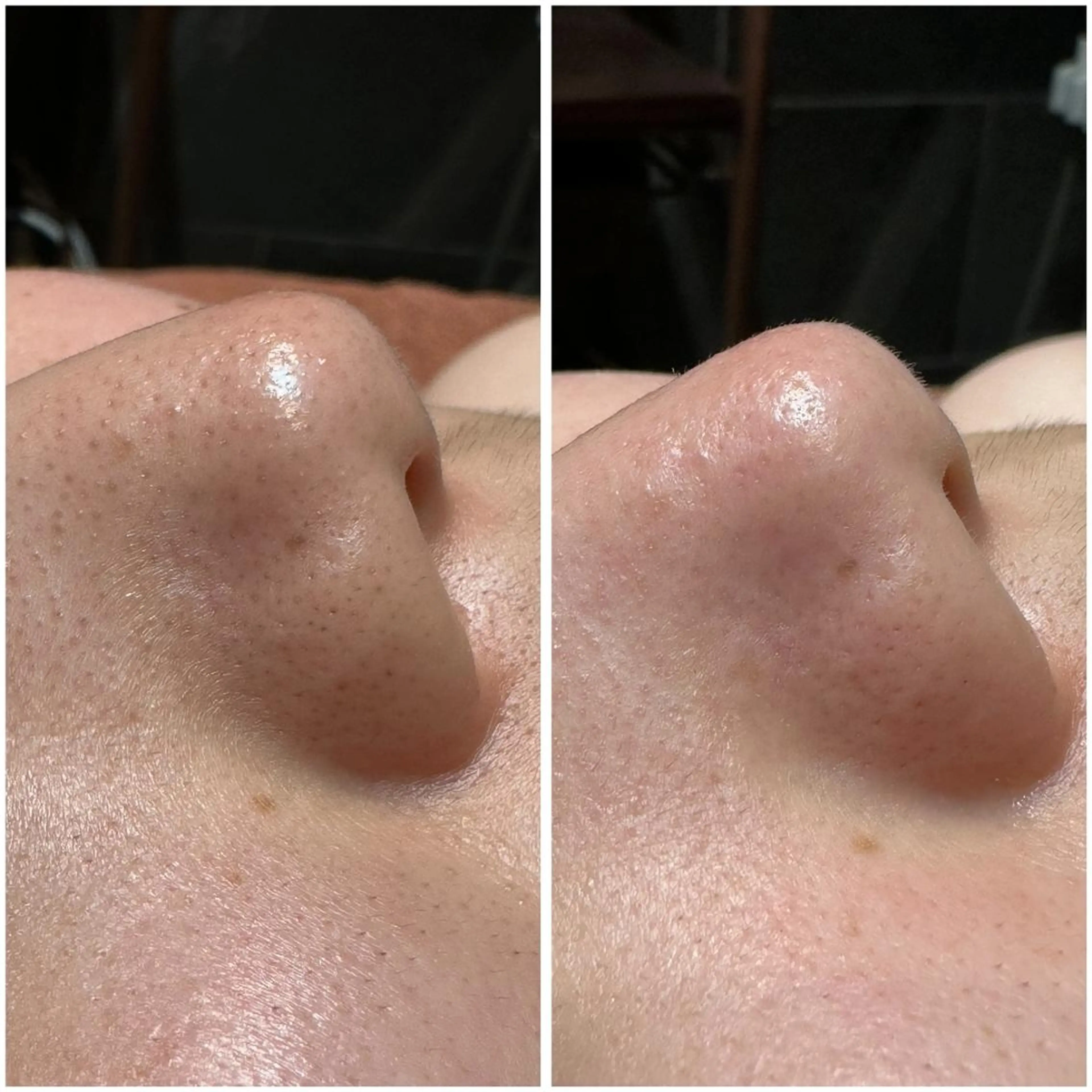 フェイシャル体験オーダーメイド90分の写真