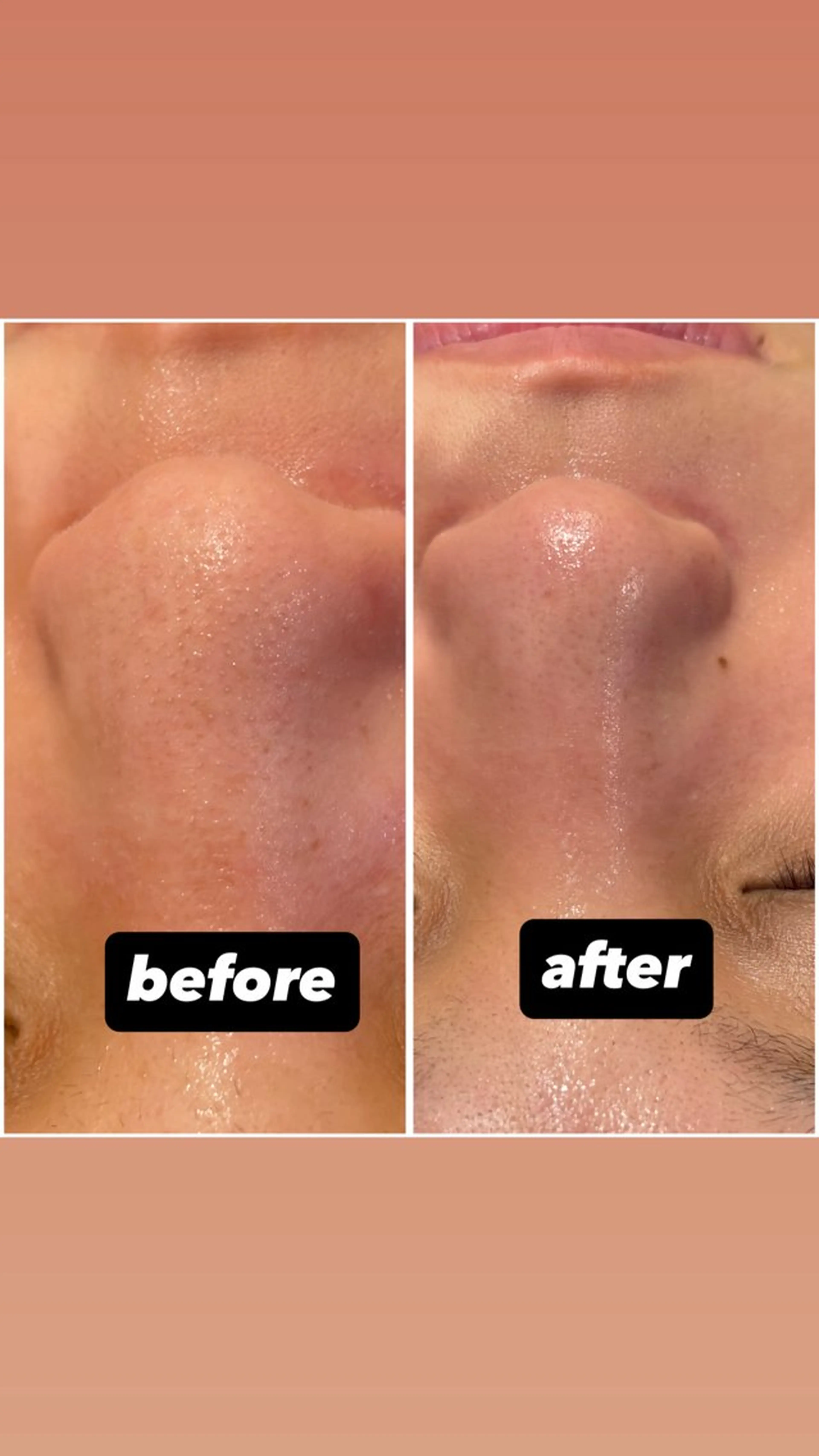 エステ 丸山 みなものエステ・リラクイメージ