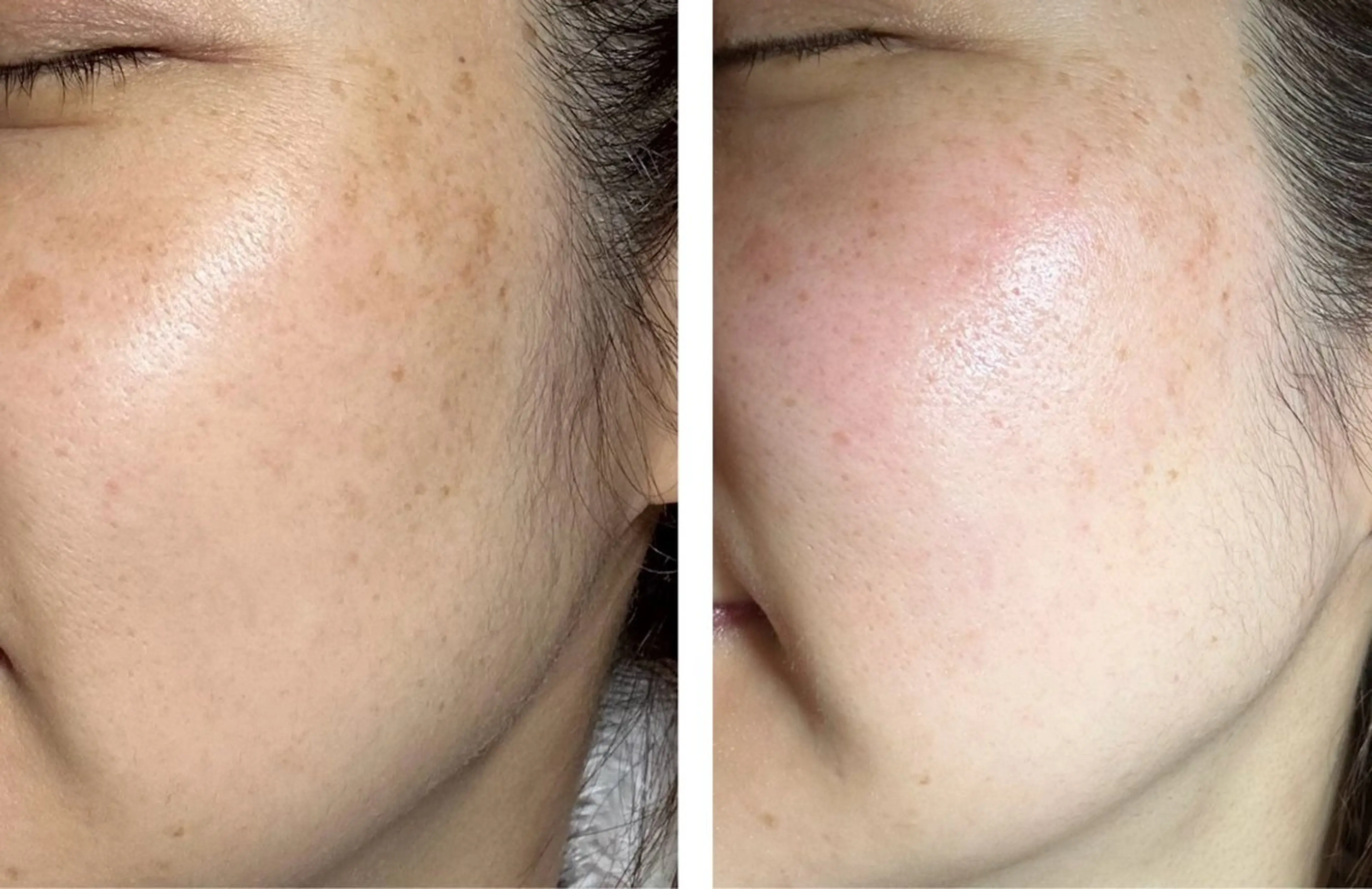 エステ 金山 沙織のエステ・リラクイメージ