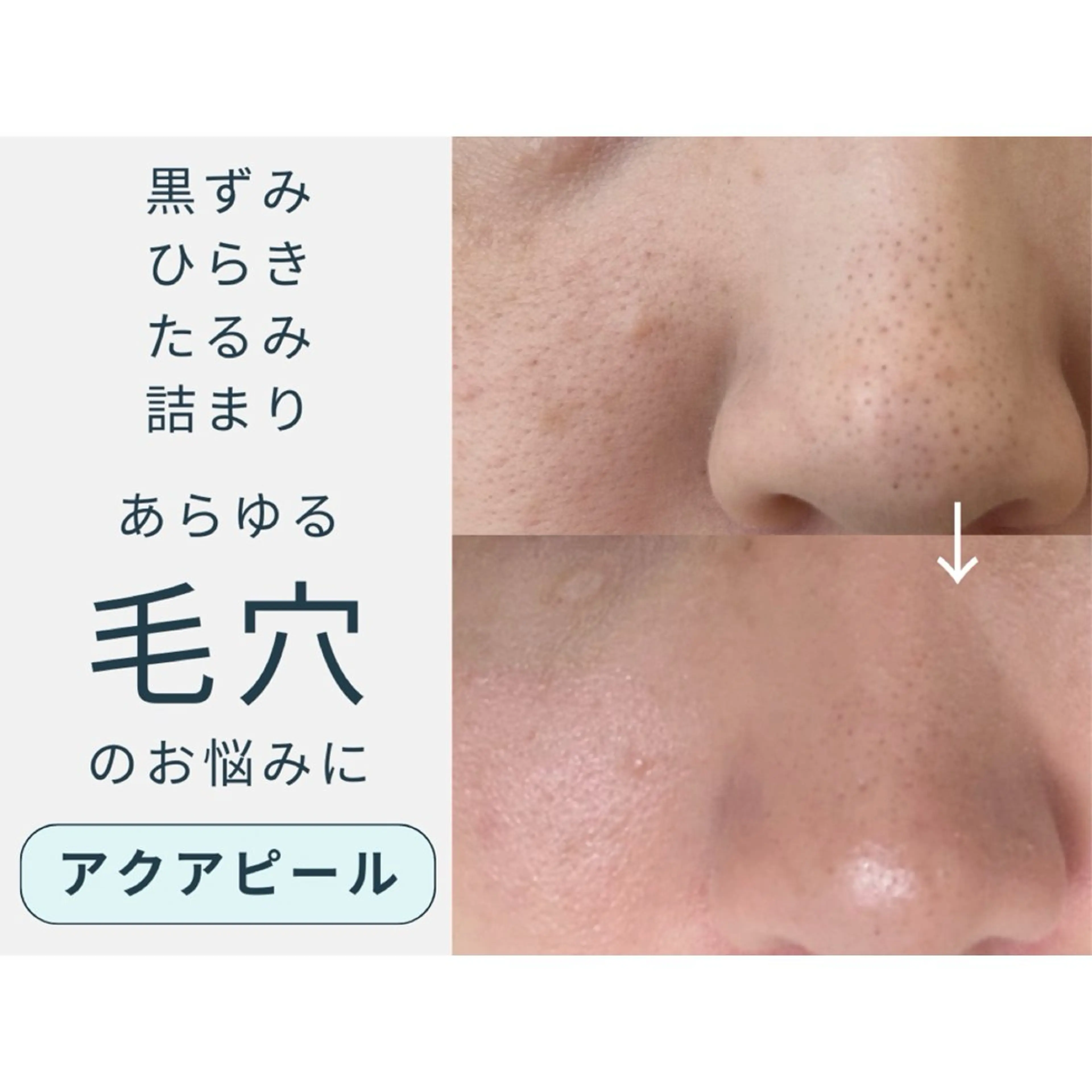 エステ swan(スワン) 韓国肌管理 南堀江のエステ・リラクイメージ