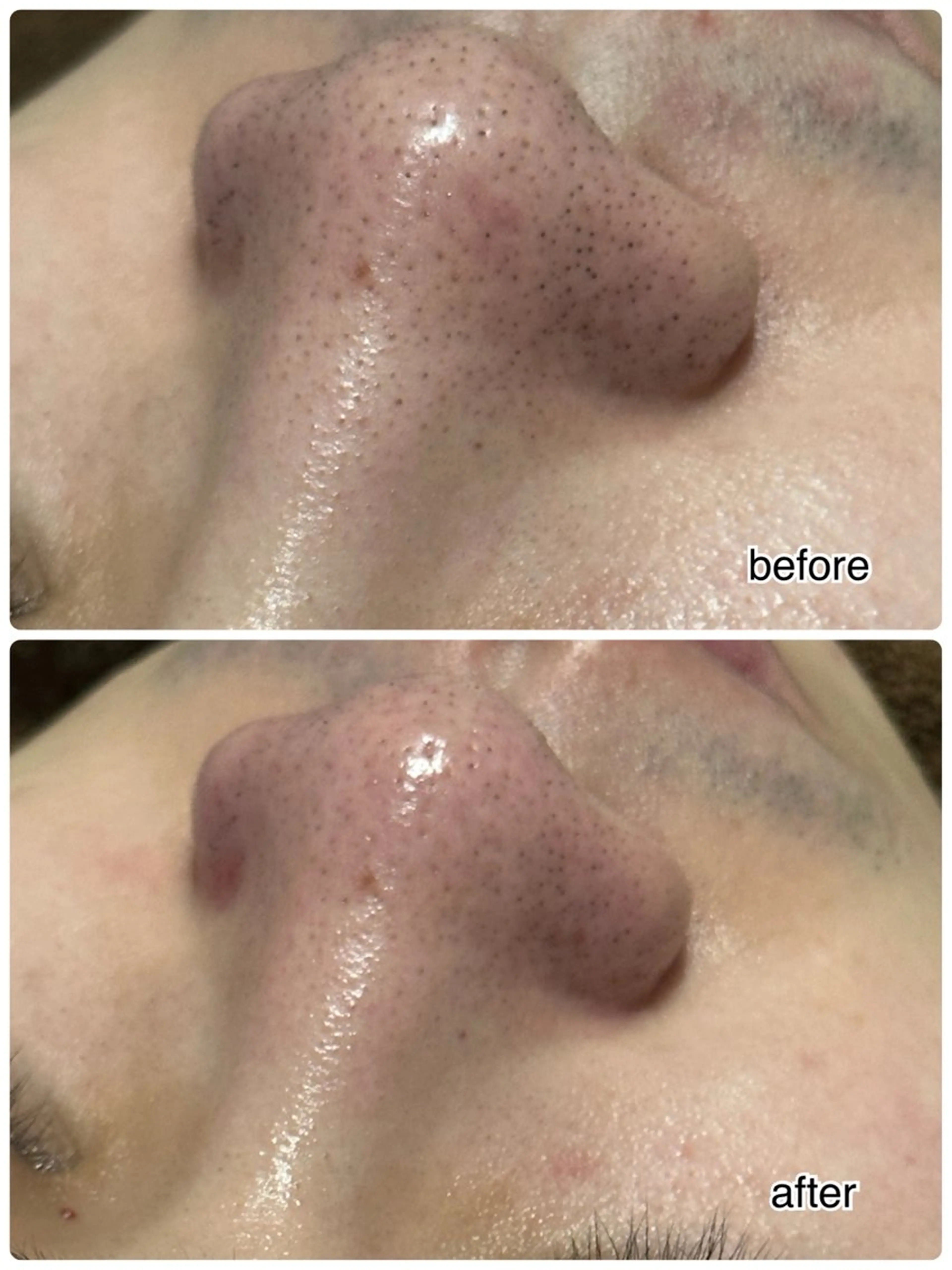 エステ ENCHANT 脱毛.小顔.毛穴のエステ・リラクイメージ