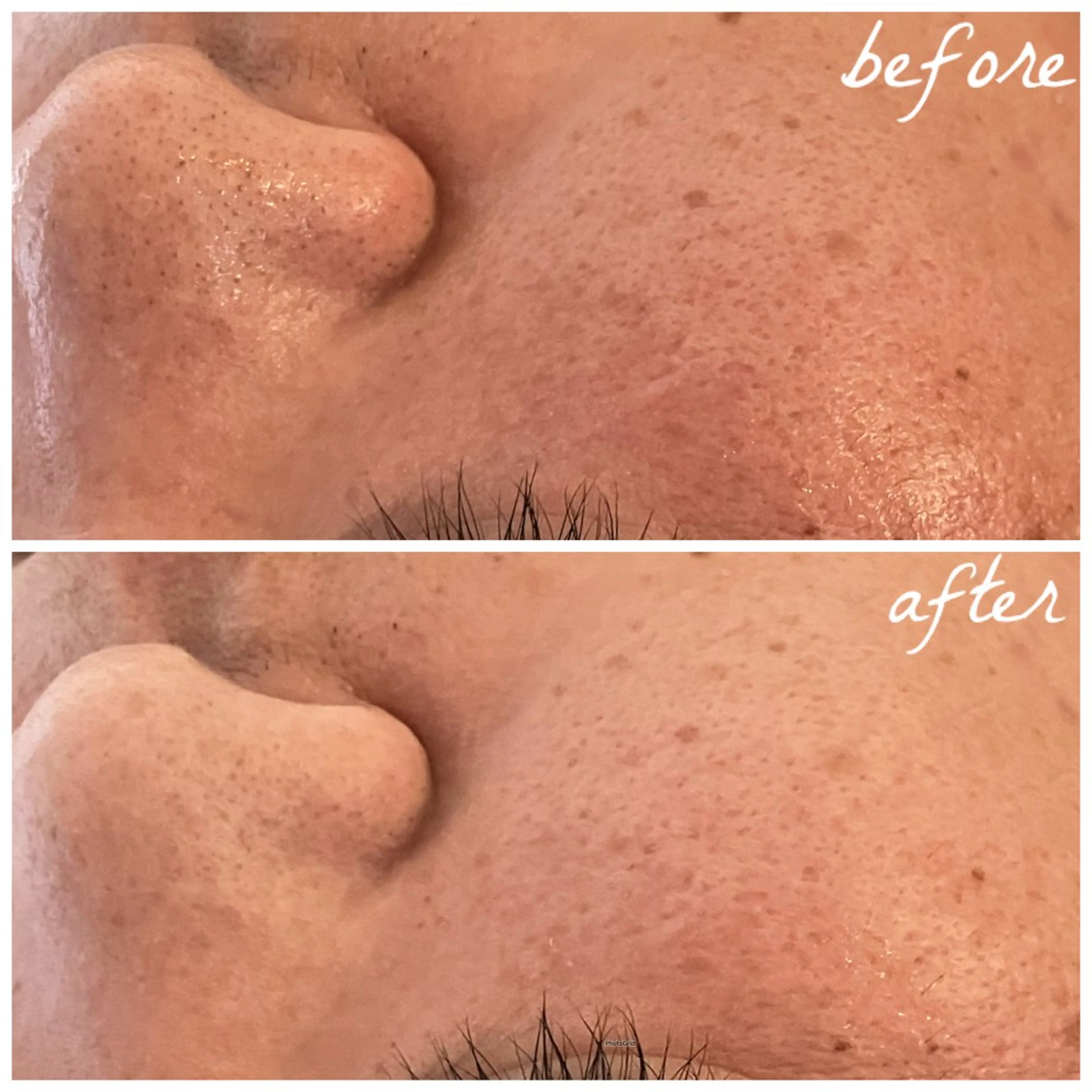 メンズ エステ メナード岐阜茜部 杉浦のエステ・リラクイメージ