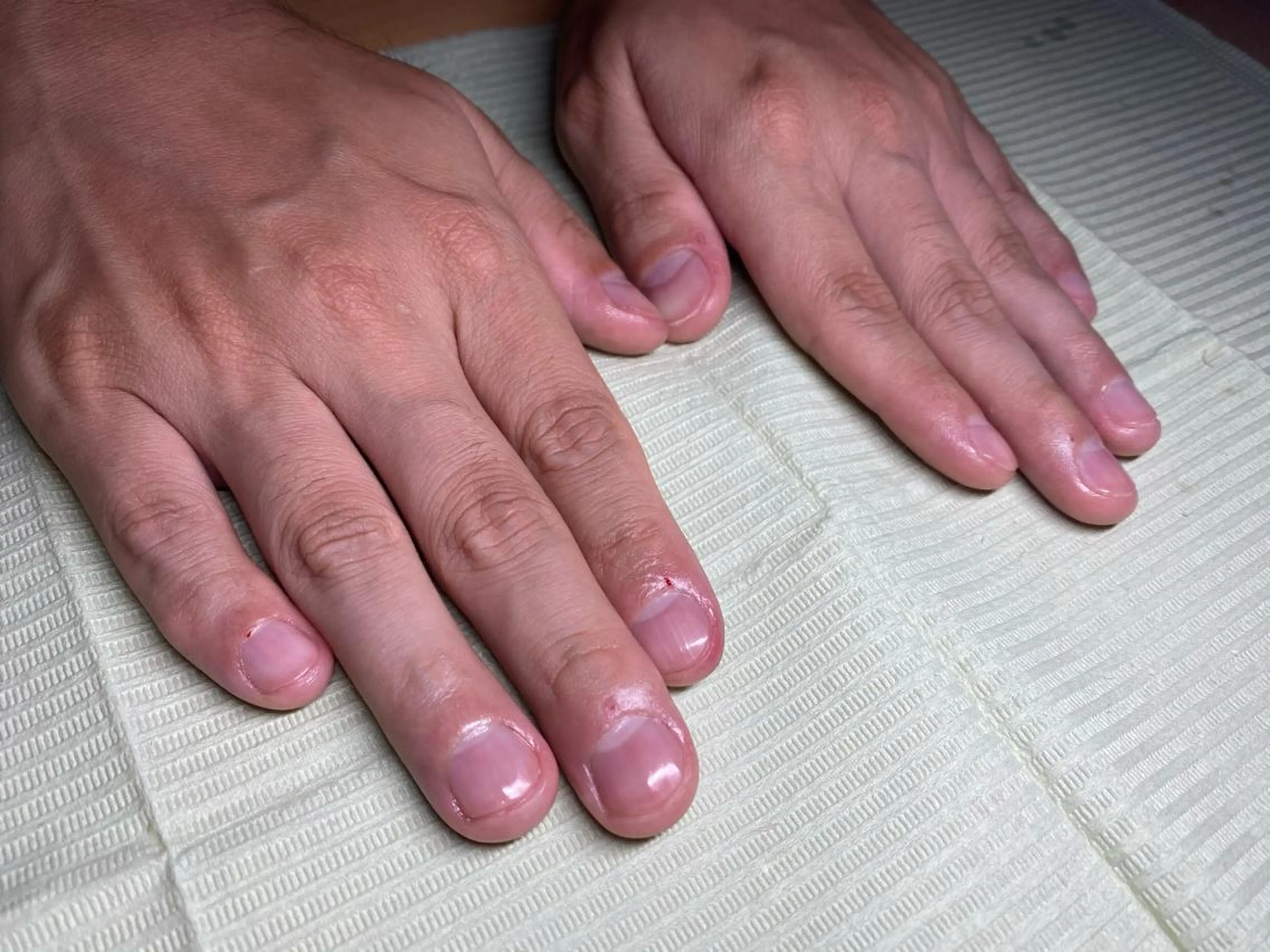 爪ケア【スタンダードコース】爪切り＋形整え＋甘皮処理＋表面磨きorトップコートの写真