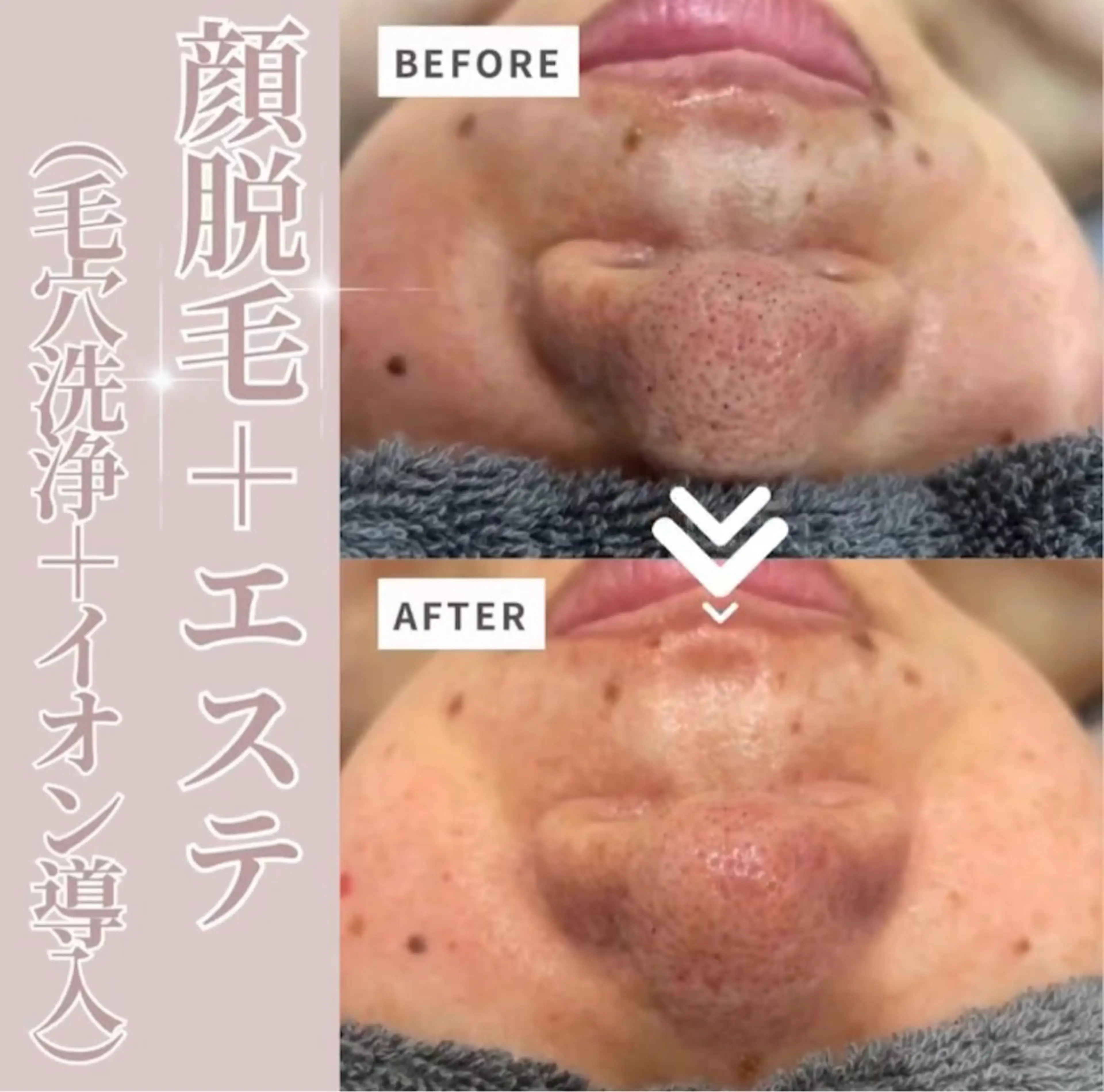 脱毛サロンALGO所属・美肌脱毛/ワックス ALGO高槻店のエステ・リラクイメージ