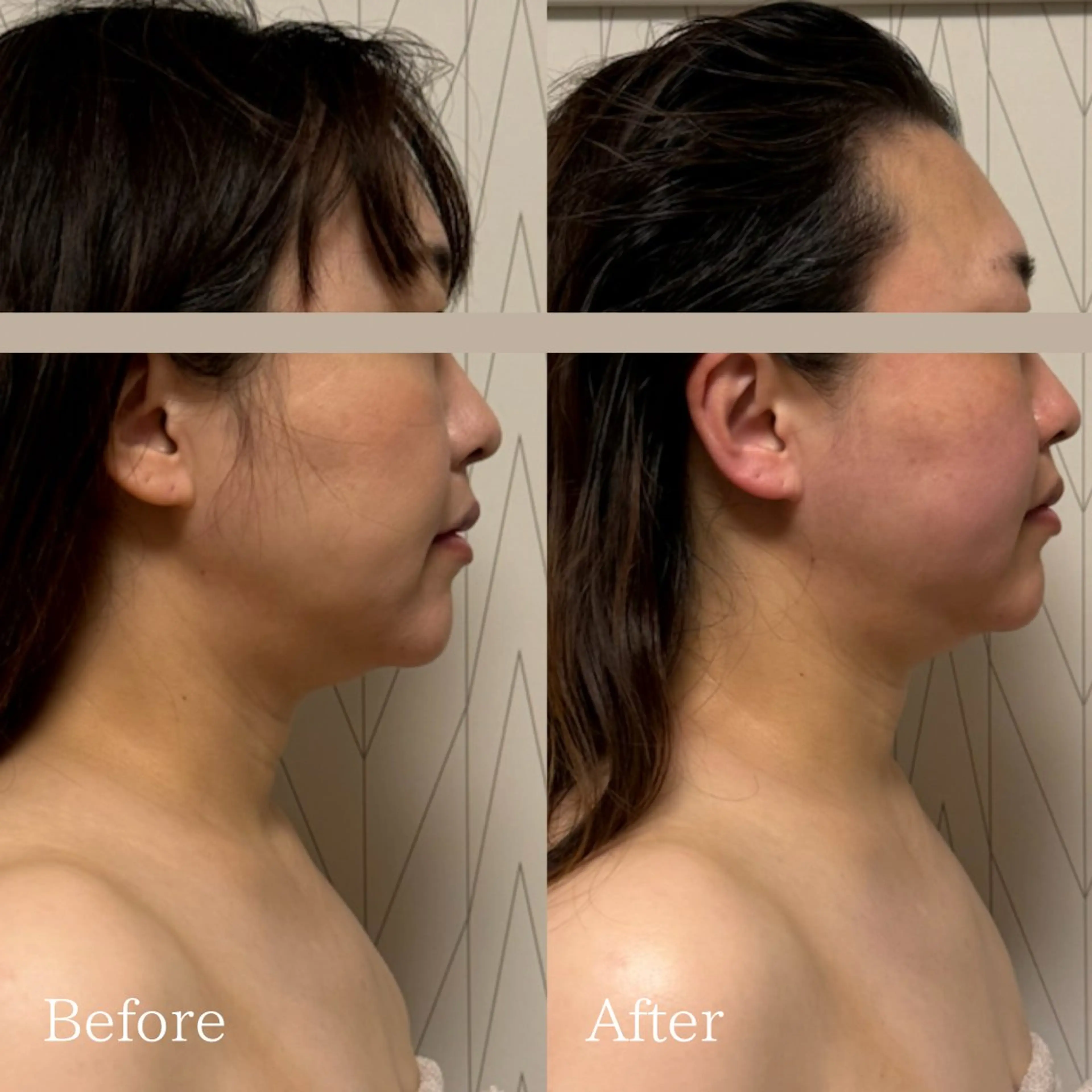 Lani Moon所属・⟡ 京都 小顔  ⊹ Lani Moonのエステ・リラクイメージ