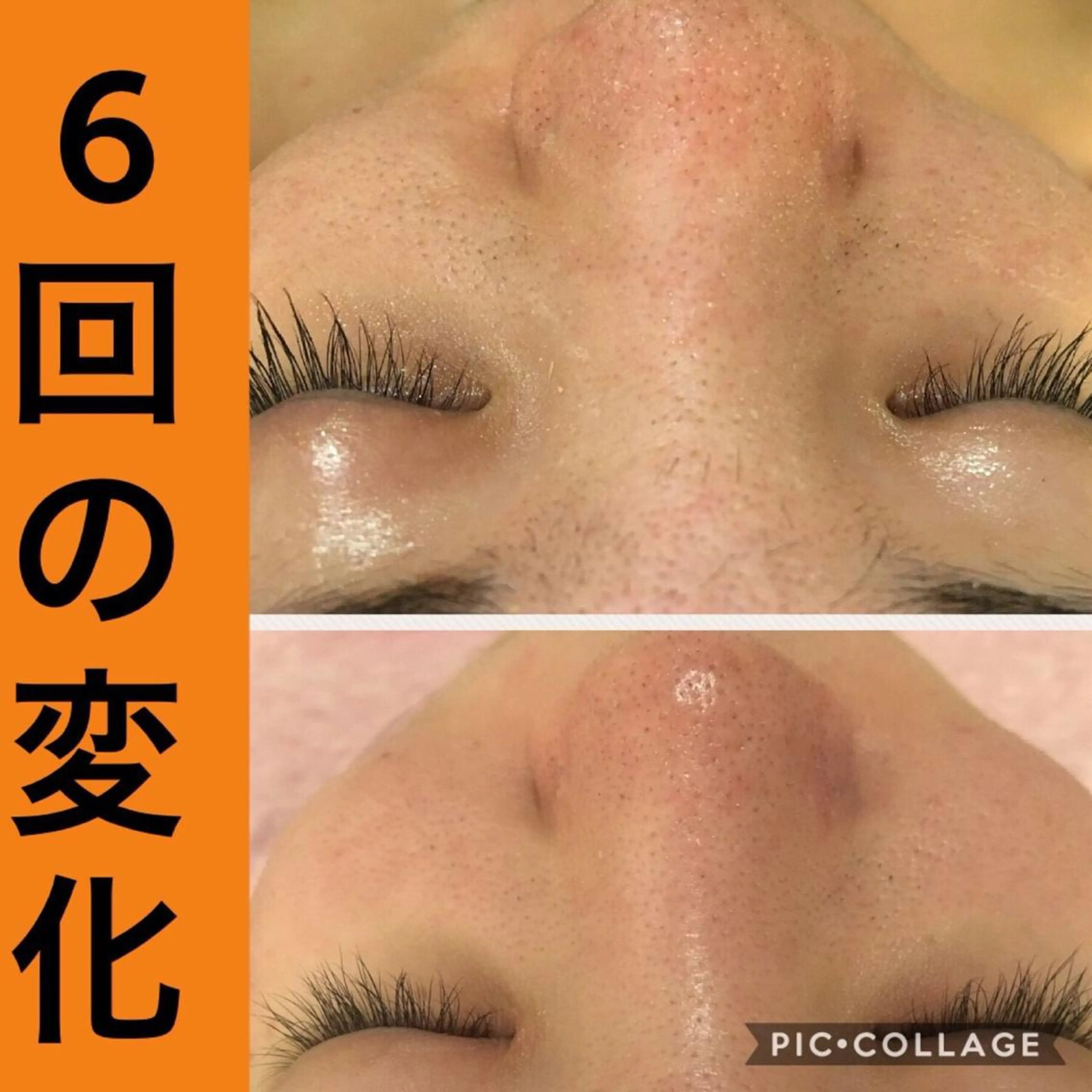 ミディアム パーマ ヘアアレンジ メンズ キッズ ネイル マツエク・マツパ ニキビ・肌質改善専門 ♡人生が変わるサロンのエステ・リラクイメージ