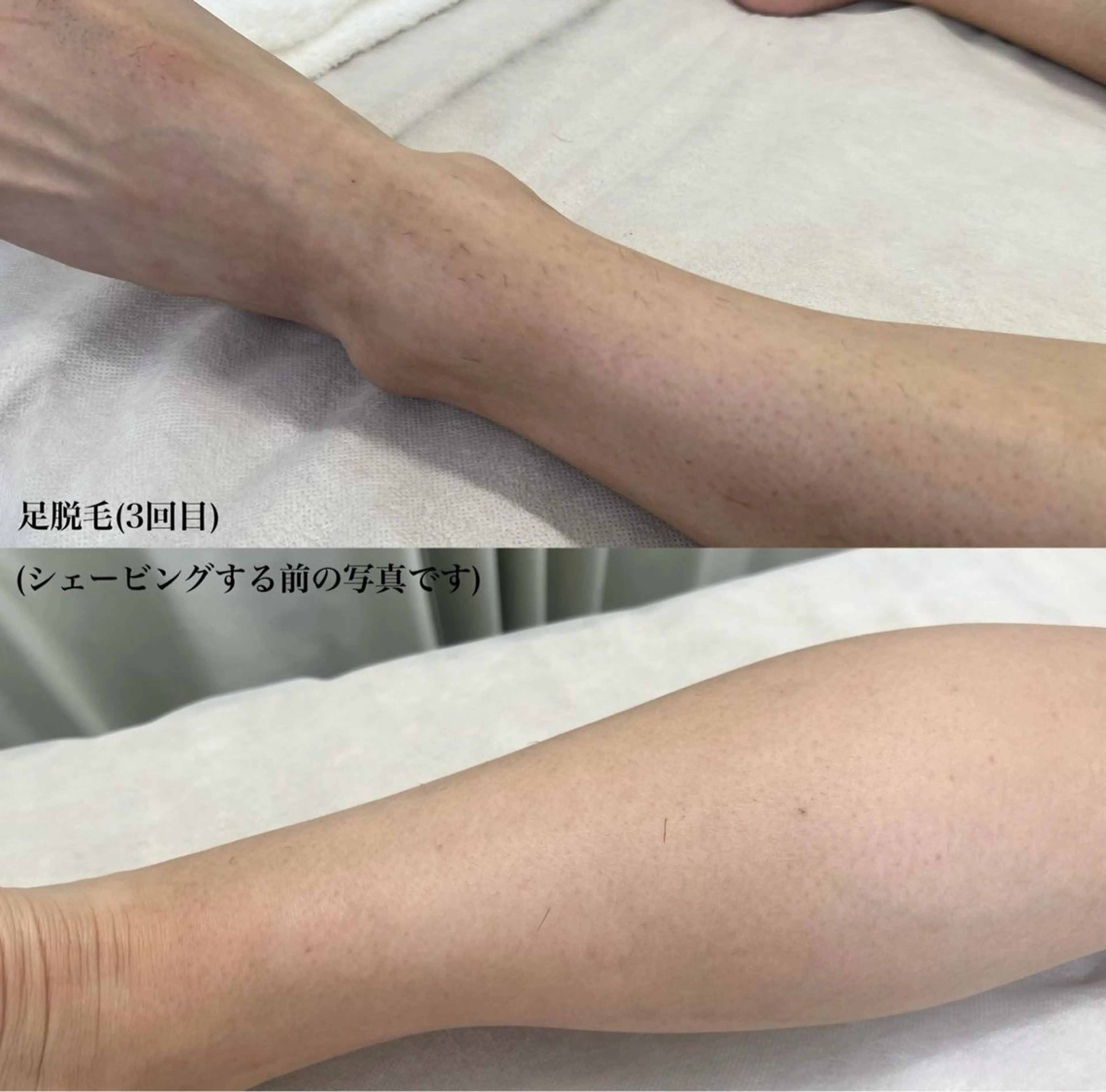 メンズ 脱毛 瀬戸 梨子のエステ・リラクイメージ