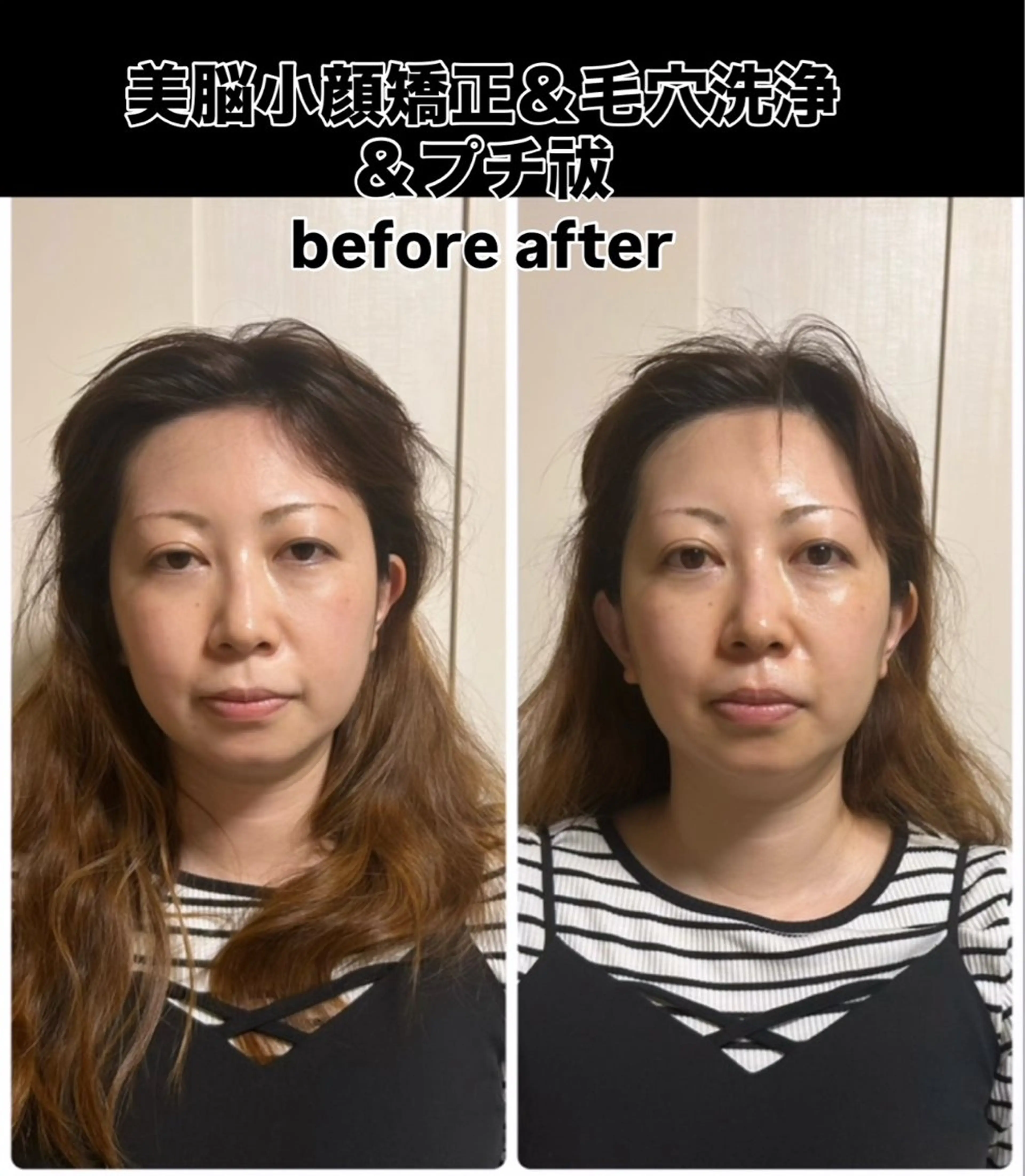 private salon favori所属・小顔矯正＆毛穴洗浄 空ルートfavoriのエステ・リラクイメージ