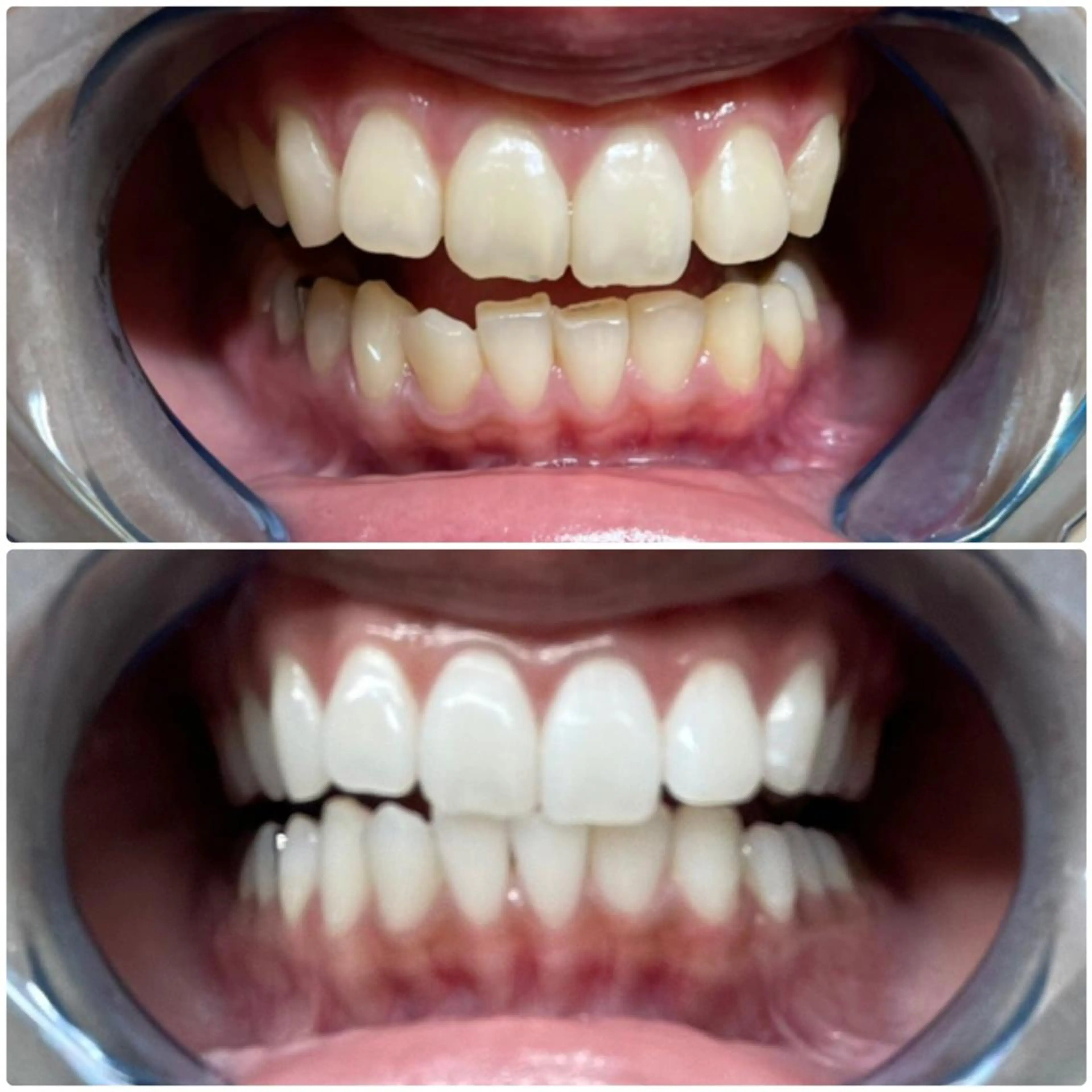 その他 ライトケアサロン 表参道店① 佐々木のその他イメージ