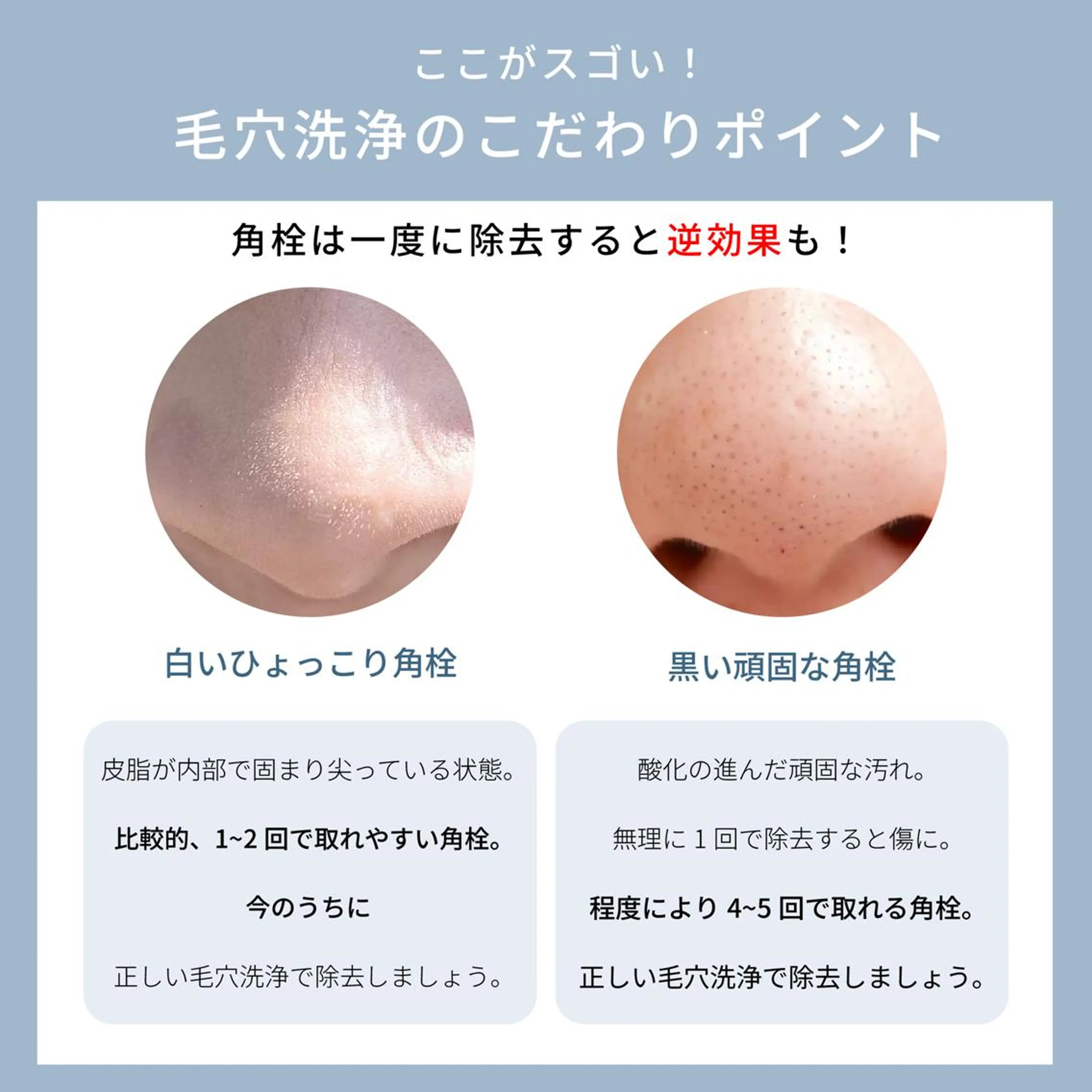 メンズ・顔の毛穴ケア フェイシャルケアのその他イメージ