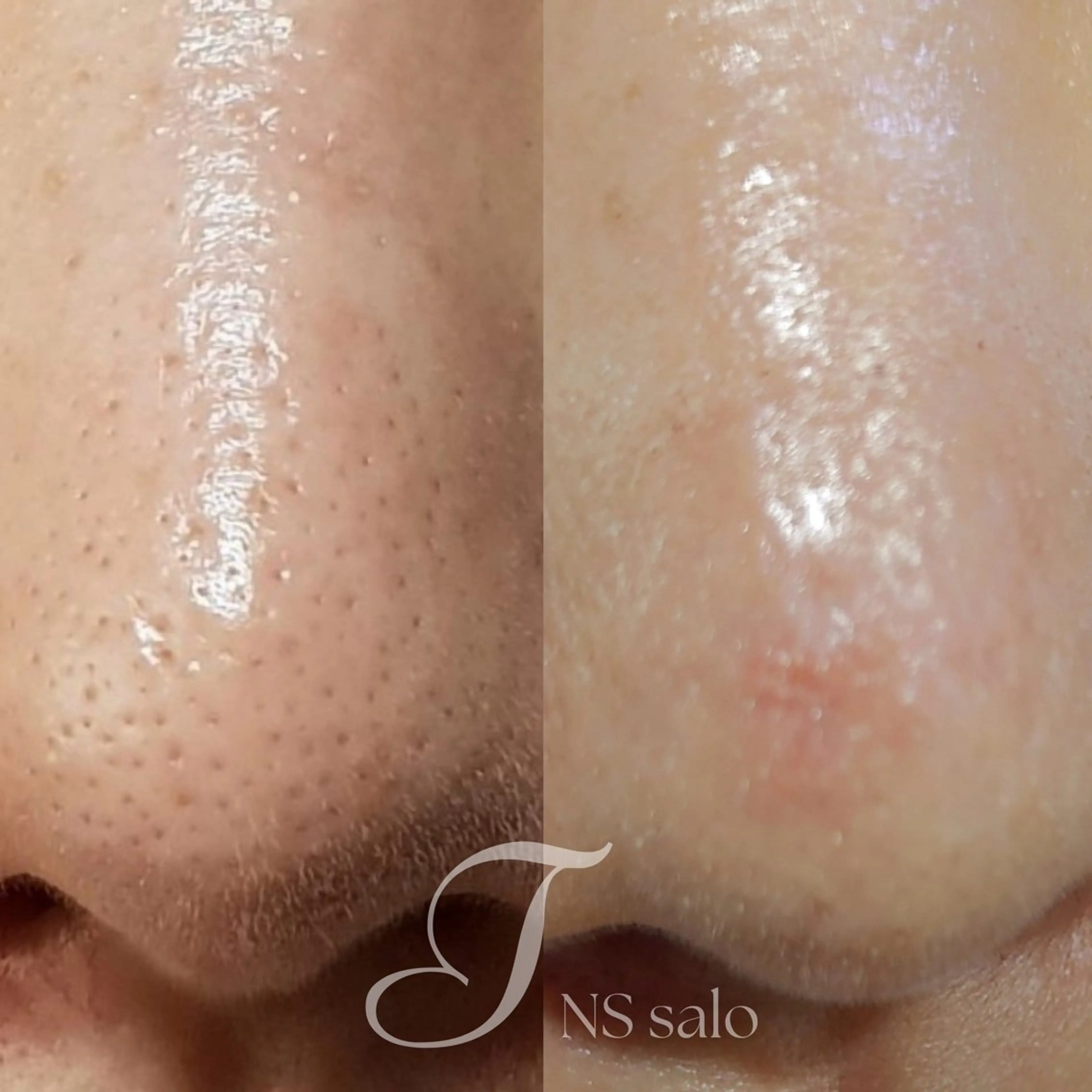 ナスサロ所属・💖韓国肌管理 :美容看護師/T🪽のエステ・リラクイメージ