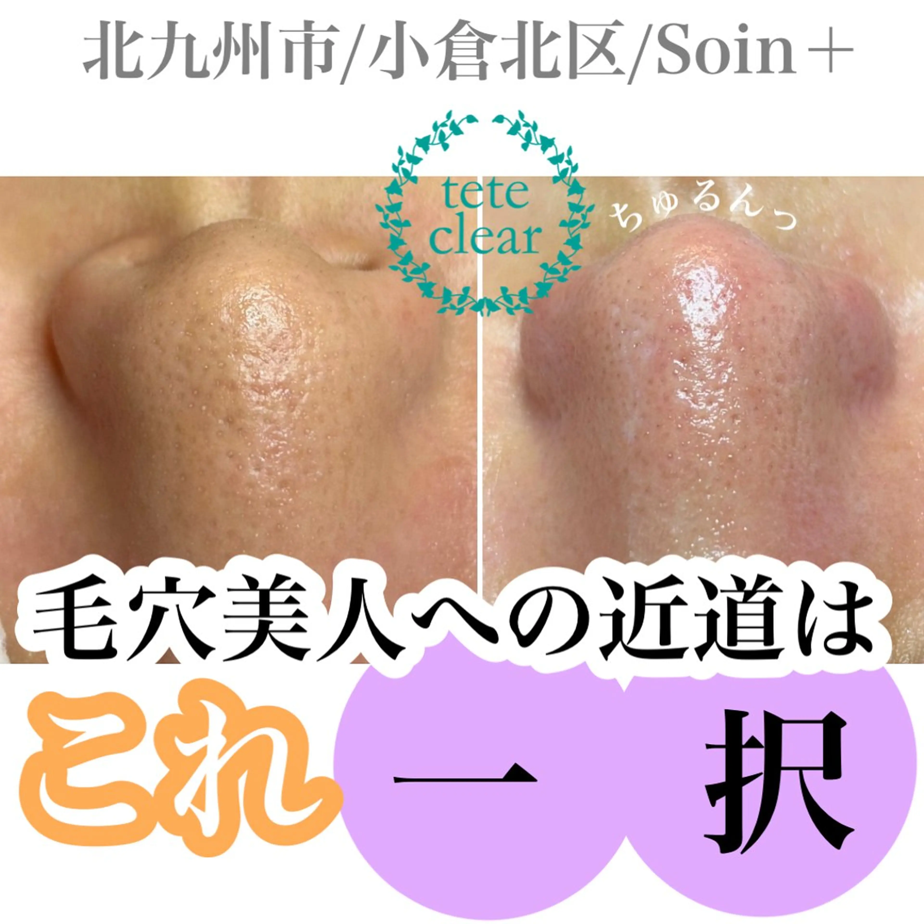 エステ Soin＋ みきのエステ・リラクイメージ