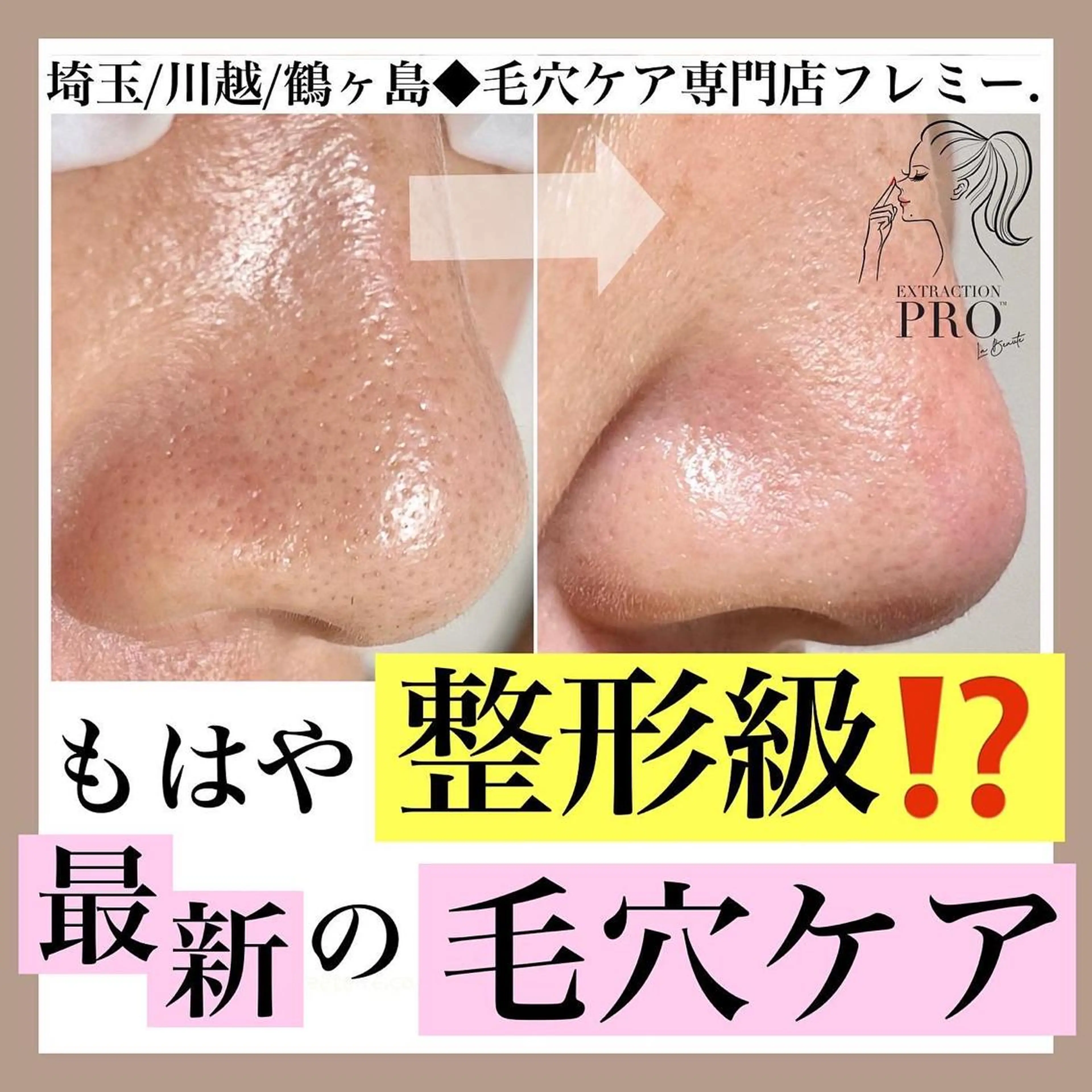 本気の毛穴改善Bコース(デコルテマッサージ付) ※毛穴エクストラクション プロの写真