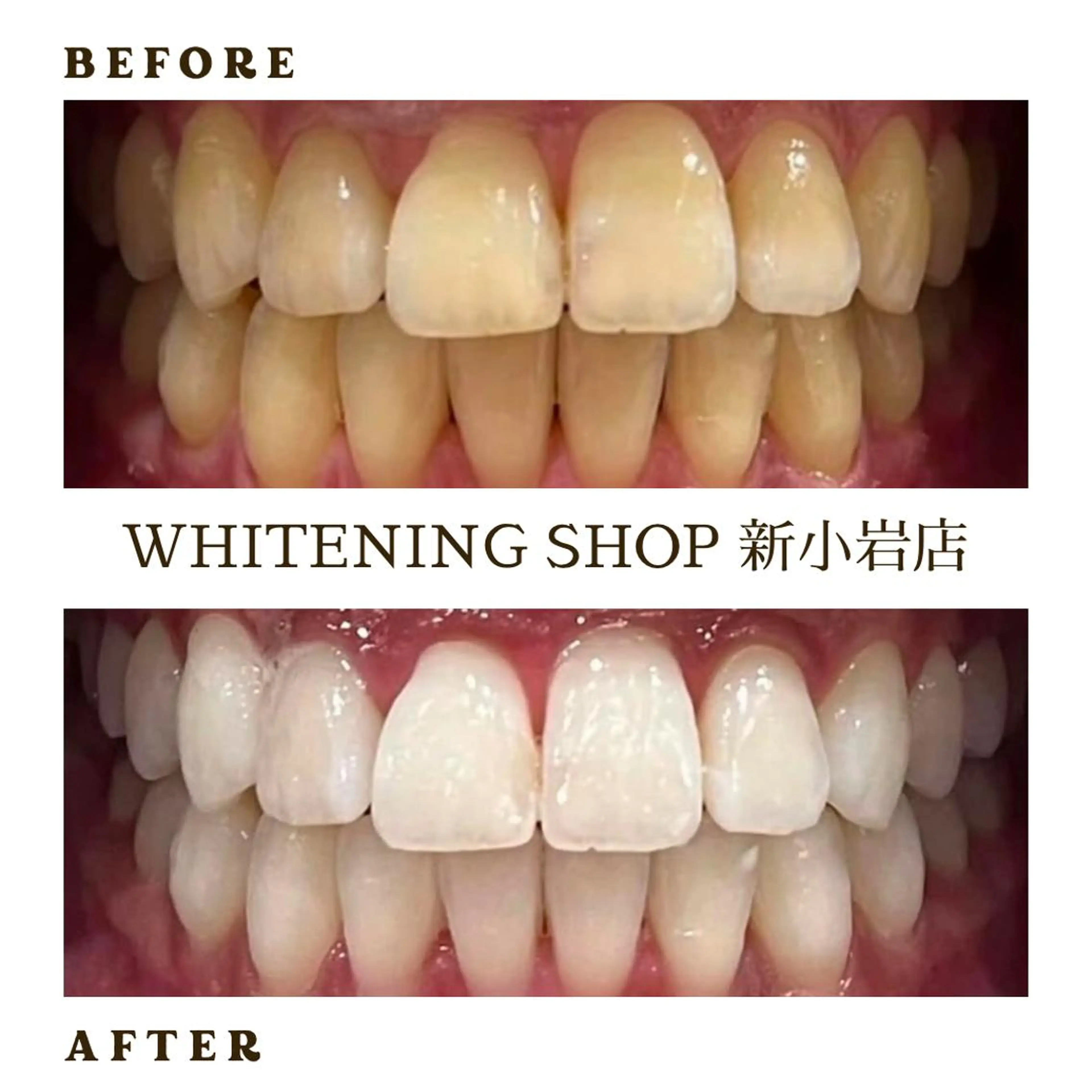 メンズ その他 ホワイトニング ショップ新小岩店のその他イメージ
