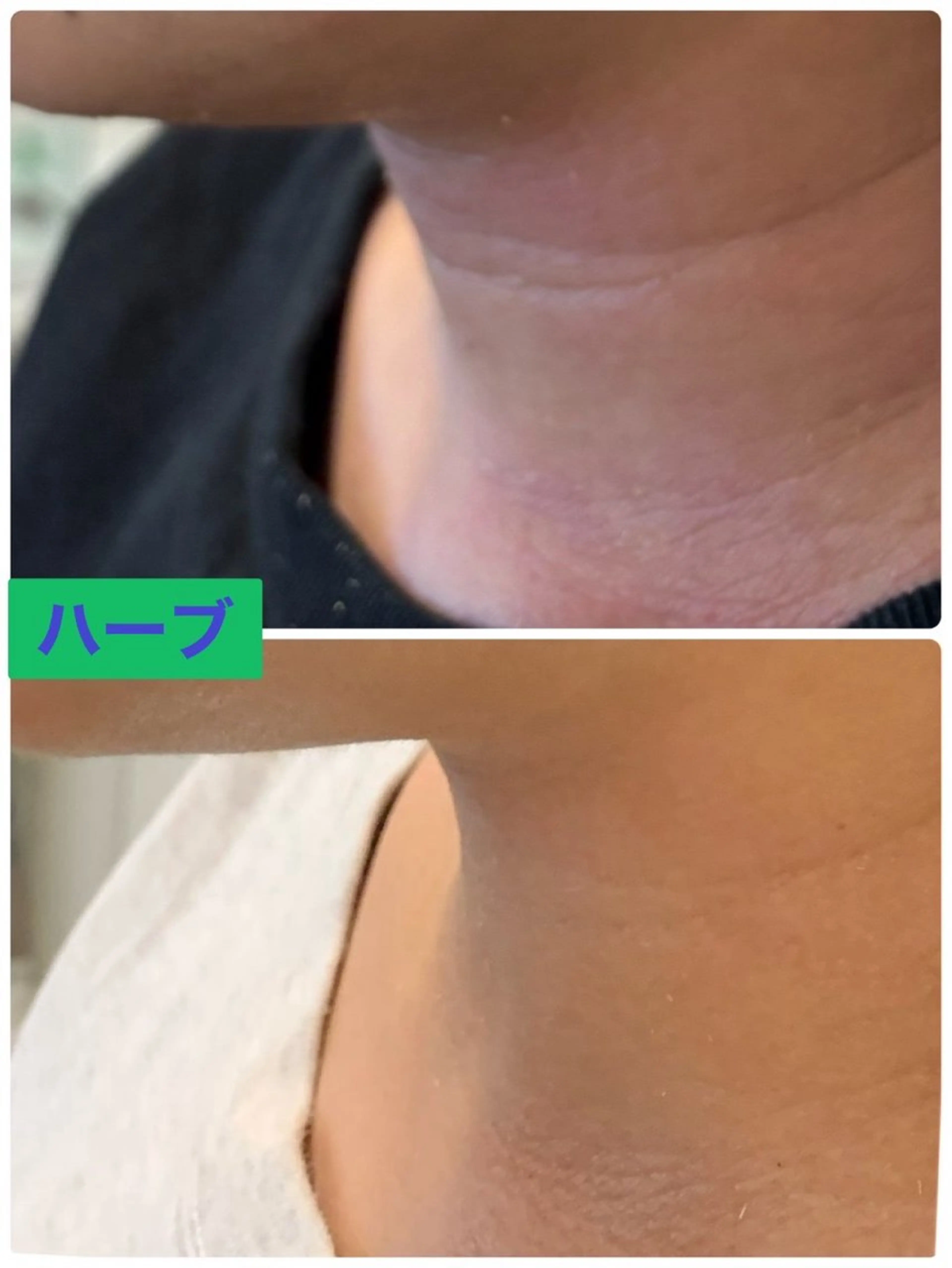 エステ Private Salon Prunelle所属・プライベートサロン プリュネルのエステ・リラクイメージ