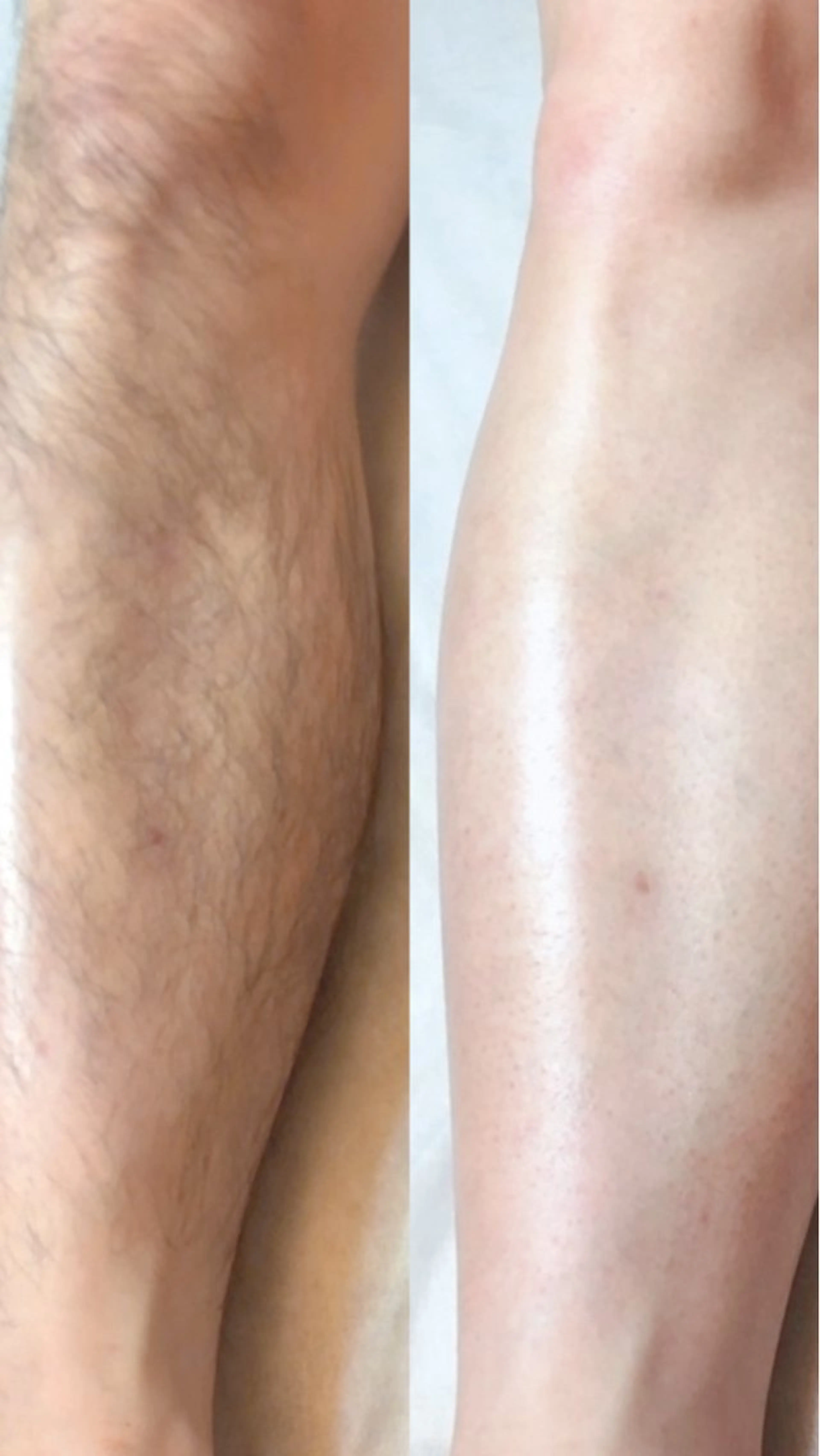 Hit. シュガーリング豊橋のエステ・リラクイメージ