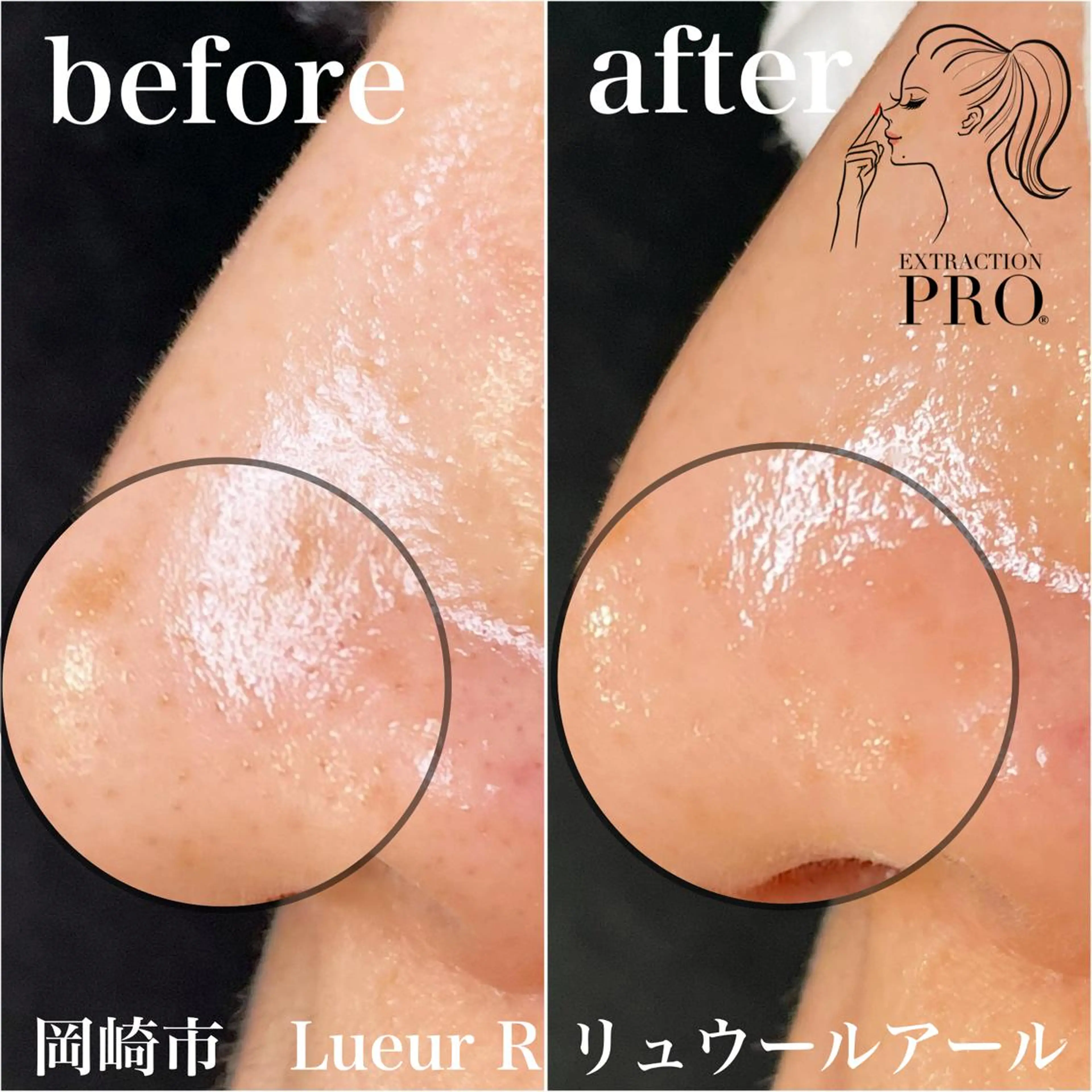 エステ 大久保 里奈のエステ・リラクイメージ