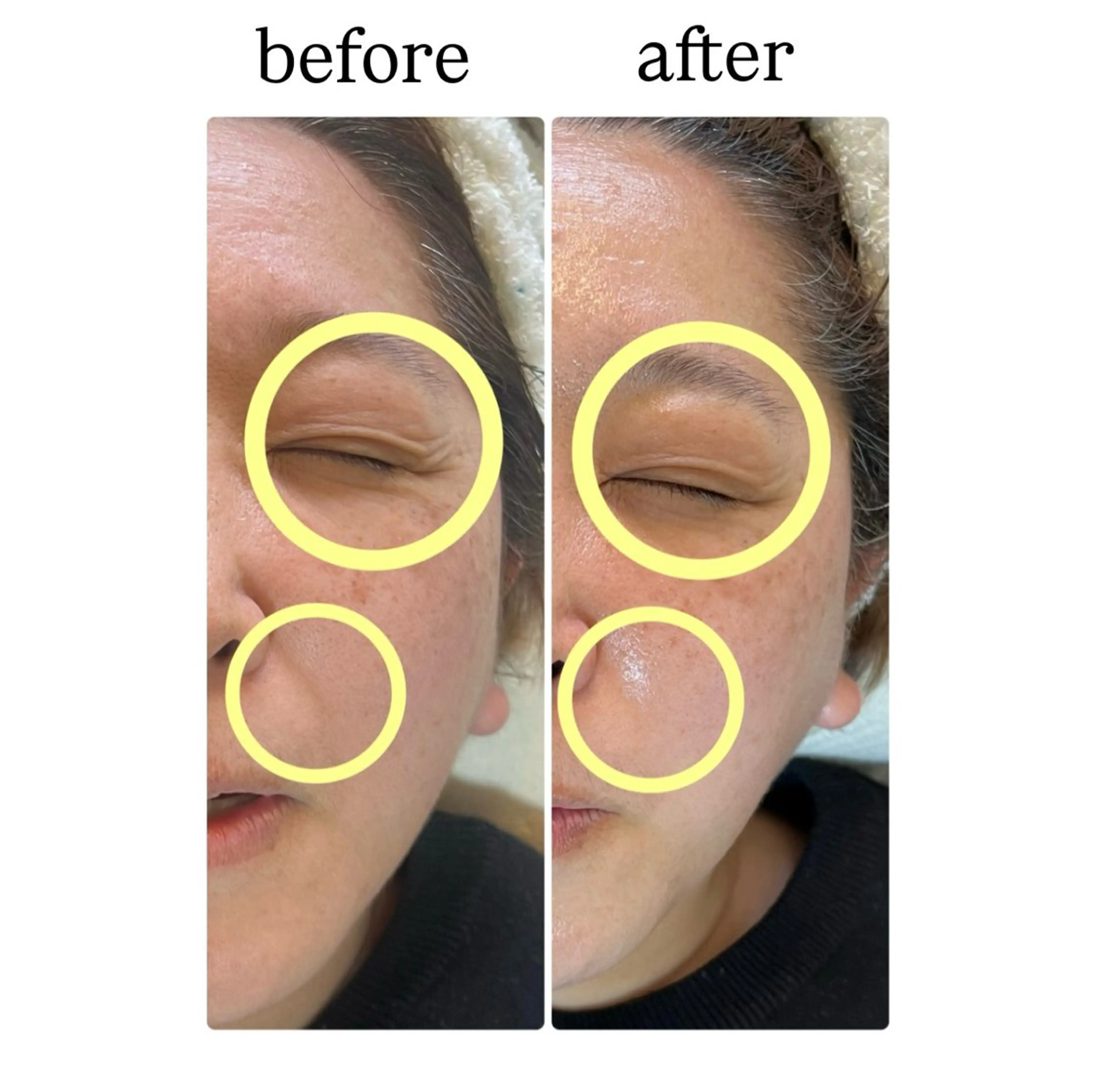 ROR Akariのエステ・リラクイメージ