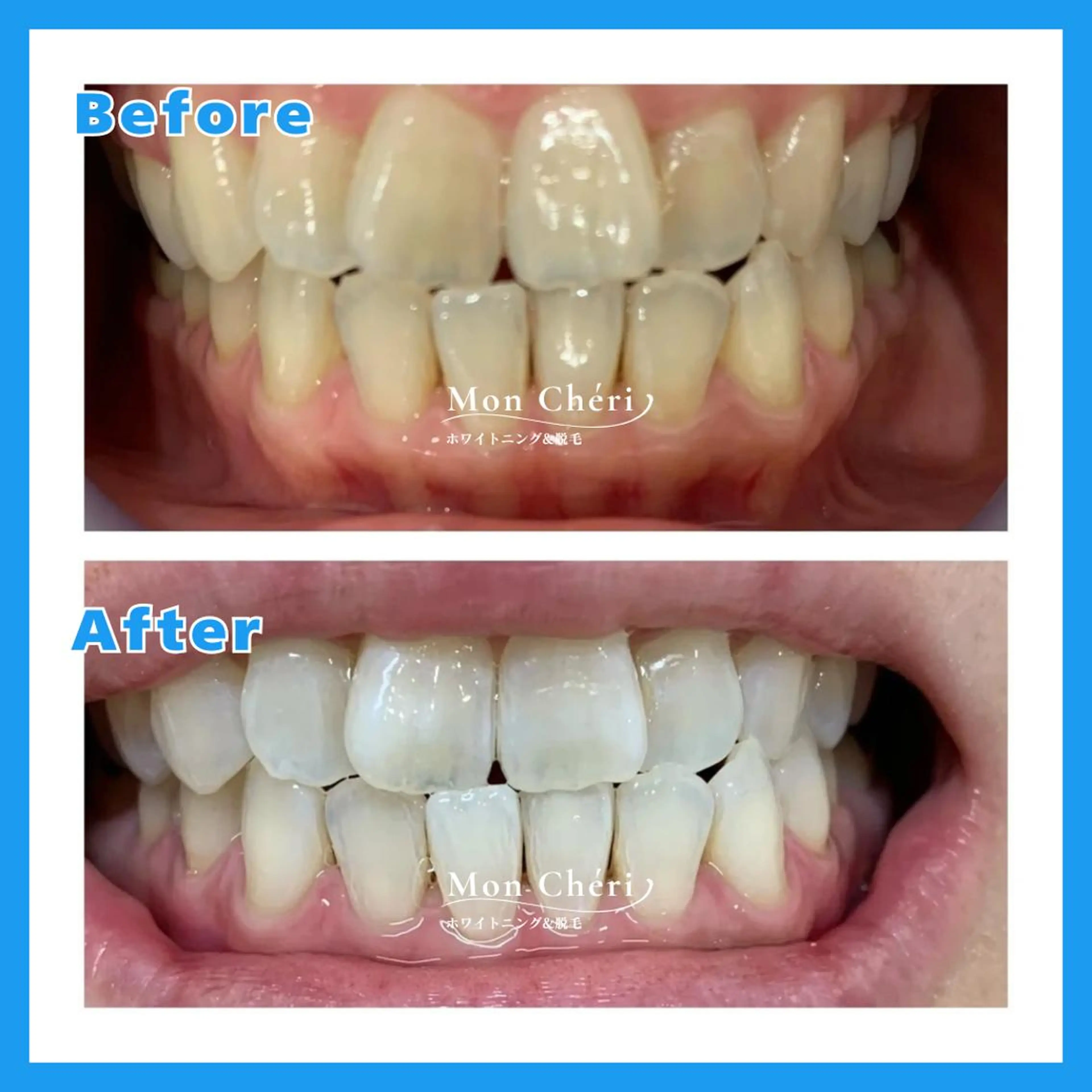 その他 Mon Cheri 広島店のエステ・リラクイメージ