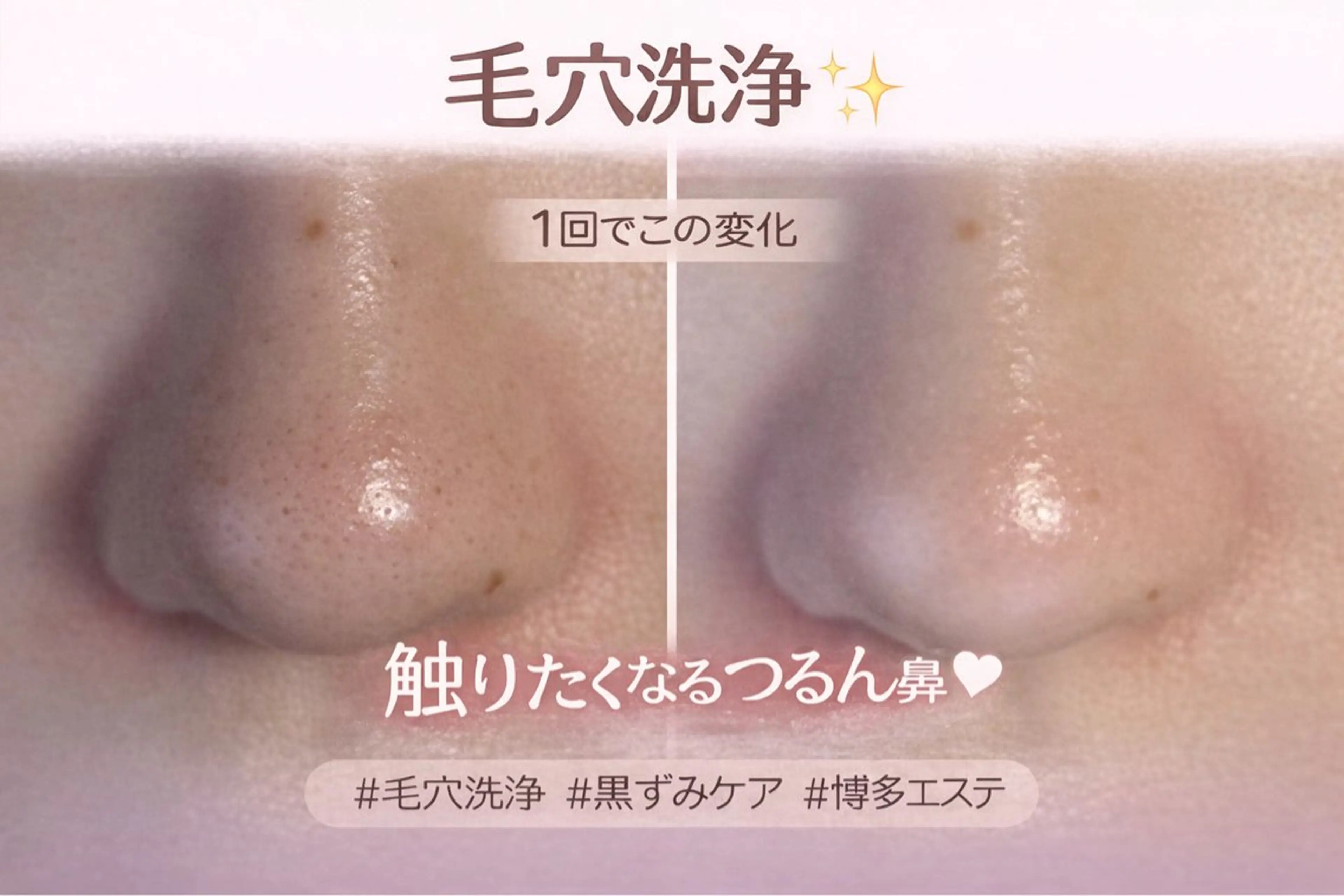 ソワン所属・脱毛 フェイシャル soin~ソワン~のエステ・リラクイメージ