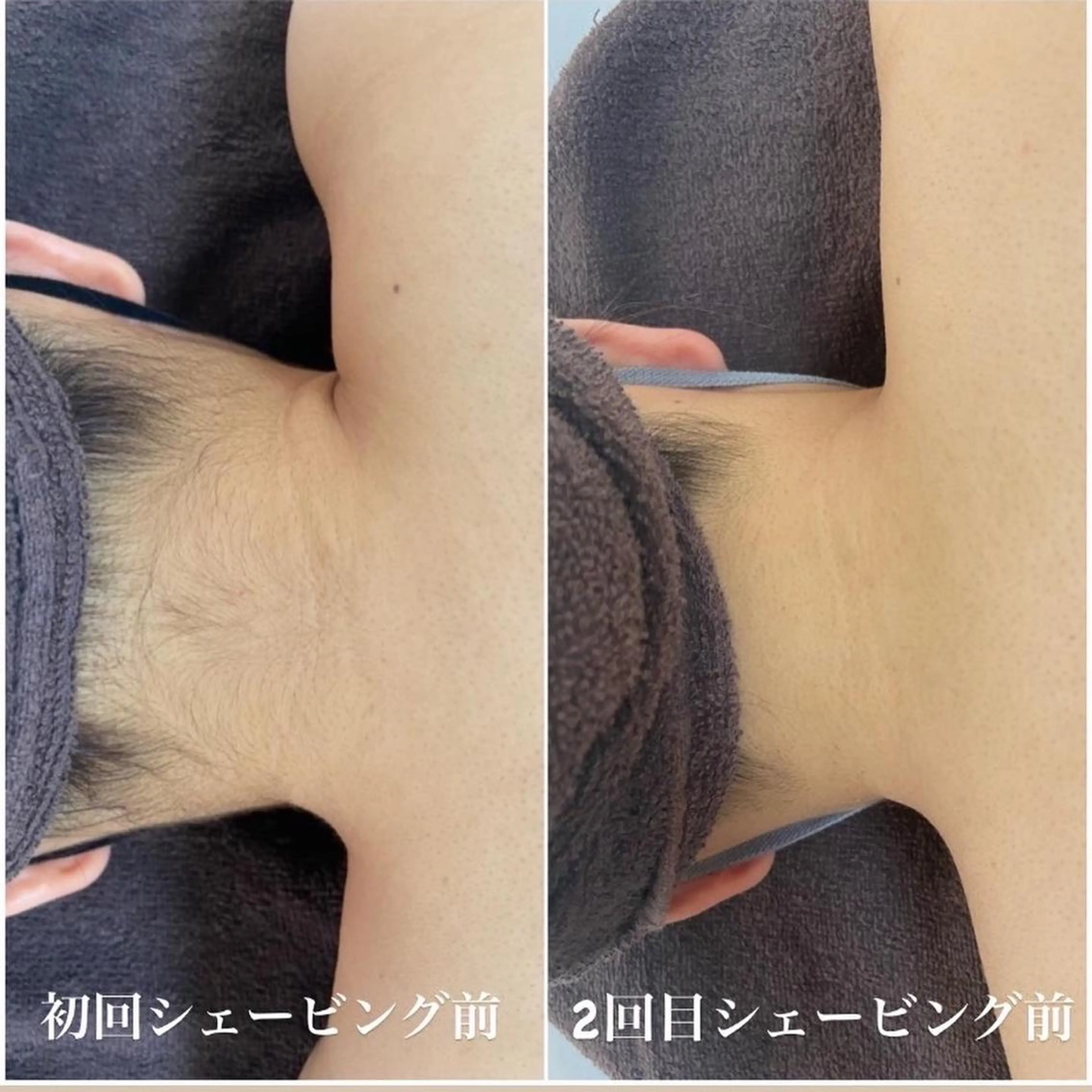 都度払い制脱毛サロンBe Charm所属・Be Charm 山﨑のエステ・リラクイメージ