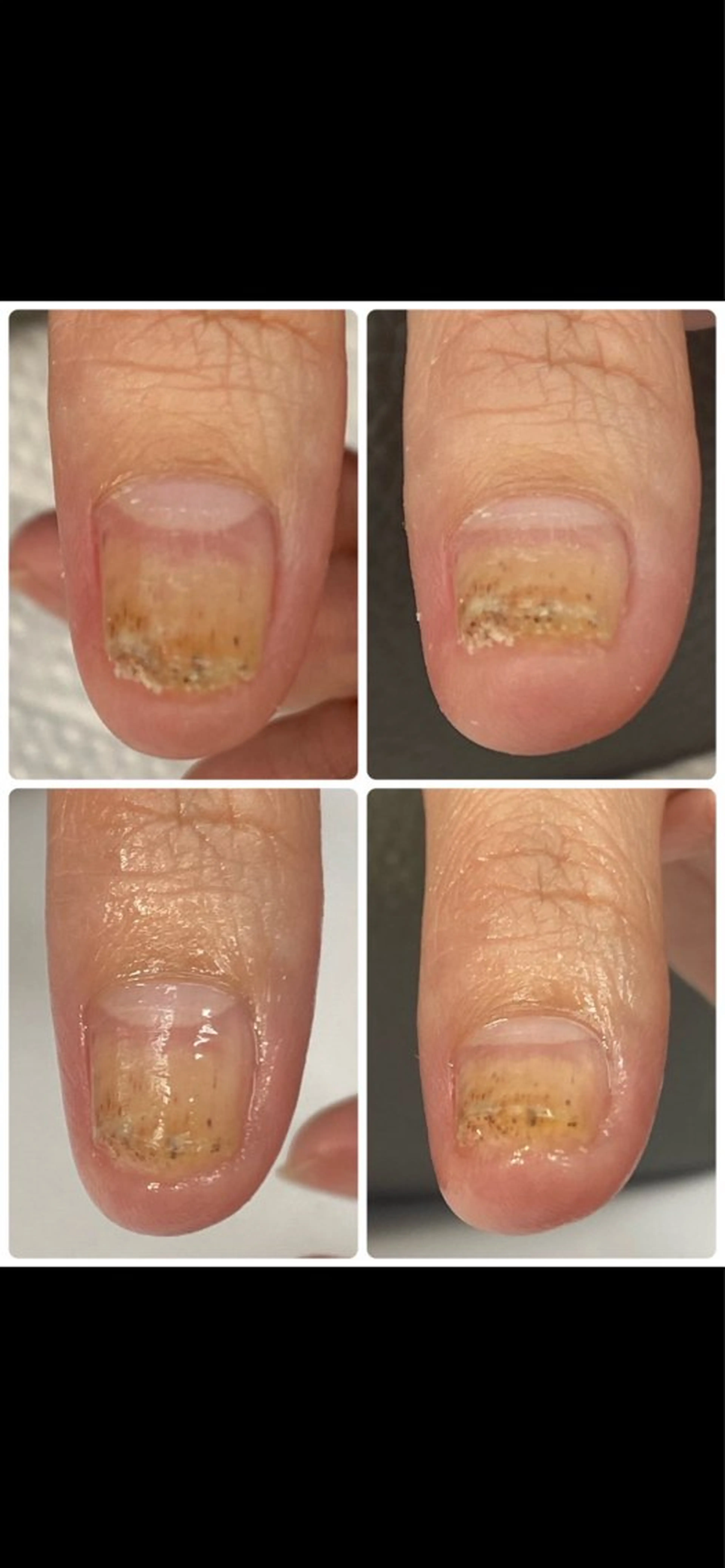 ネイル Belulu所属・Belulu ベルルのネイルデザイン