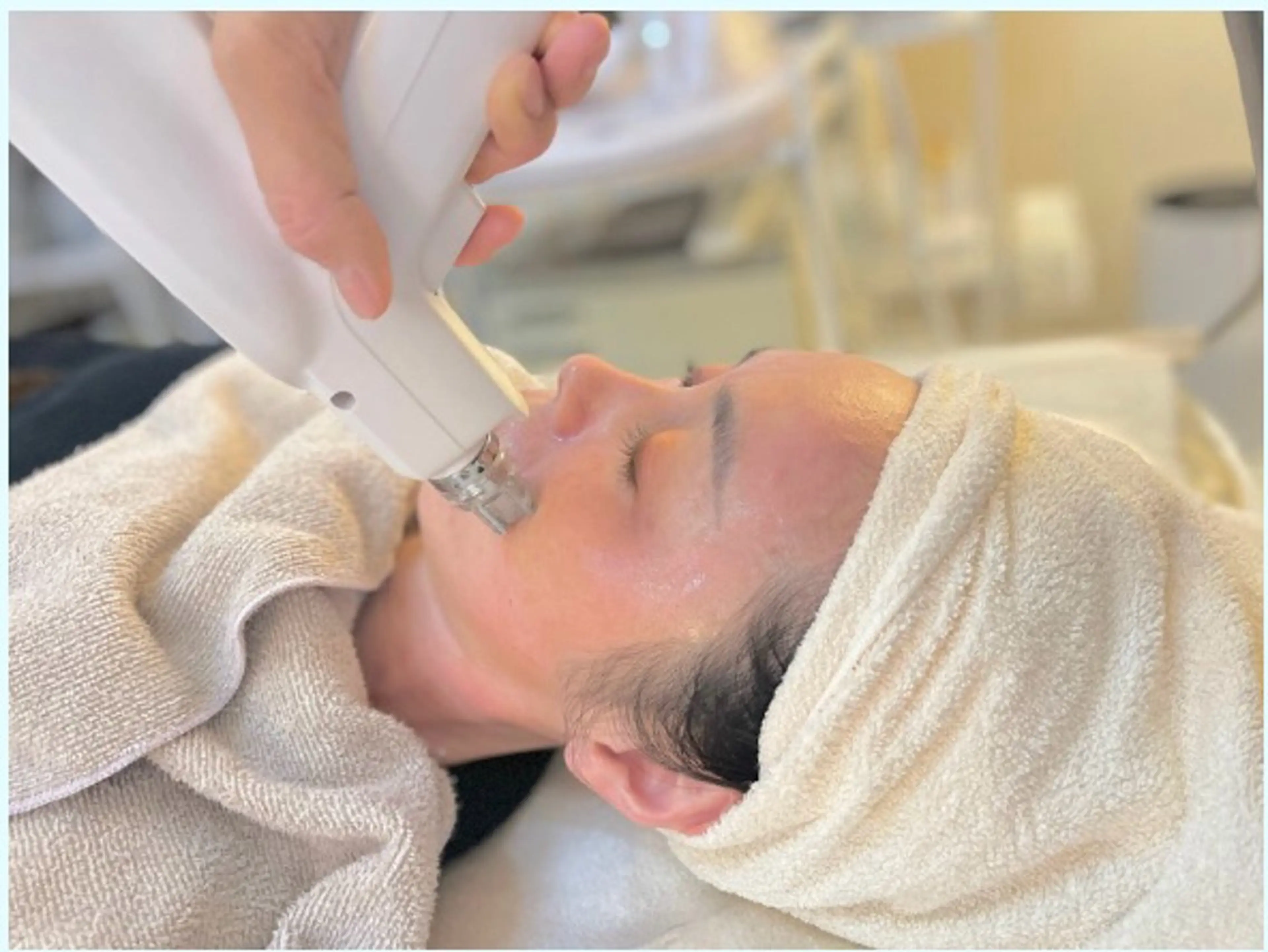 エクソソーム導入×ハーブピーリングの写真