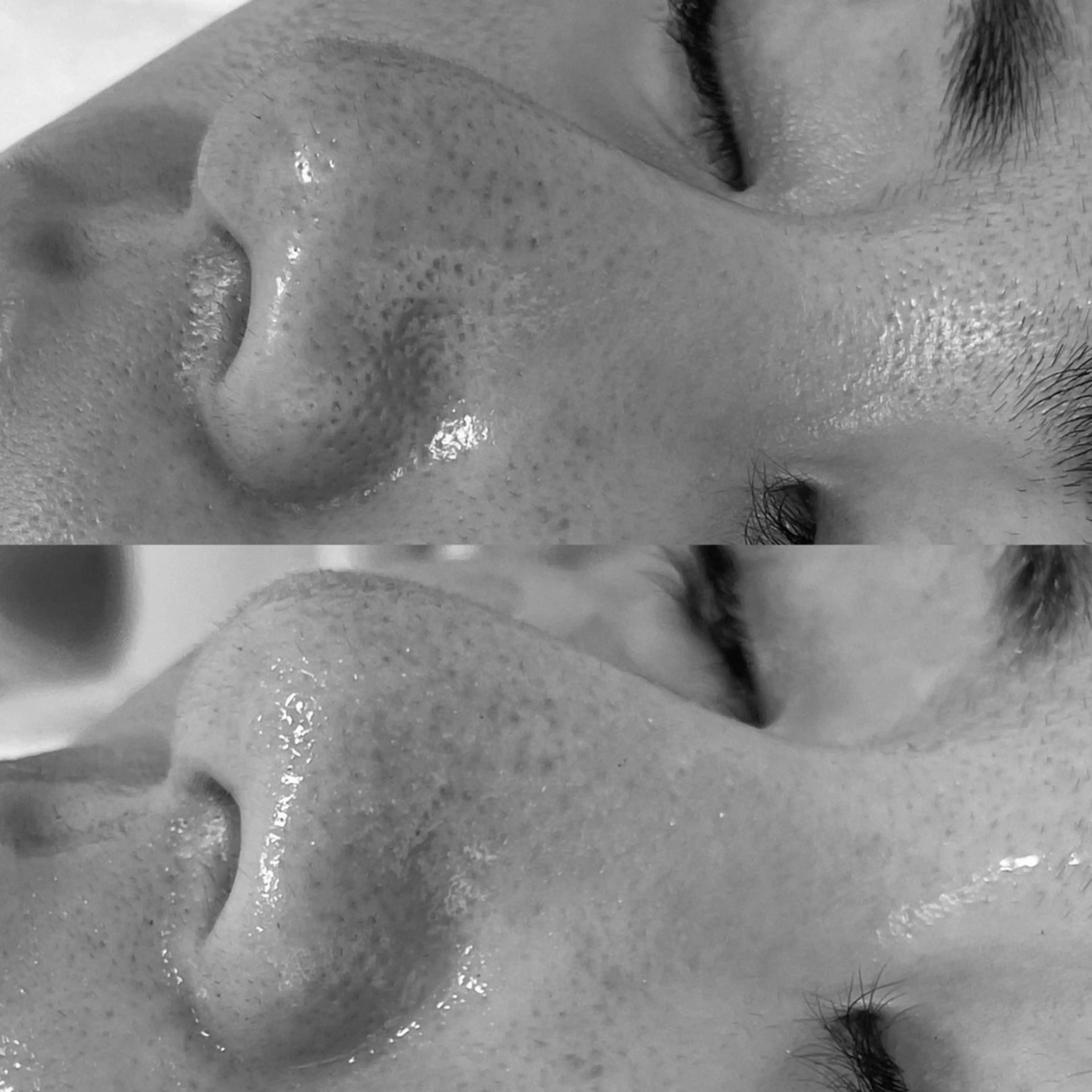 private salon éclat所属・ニキビ・毛穴専門 éclat/エクラのエステ・リラクイメージ