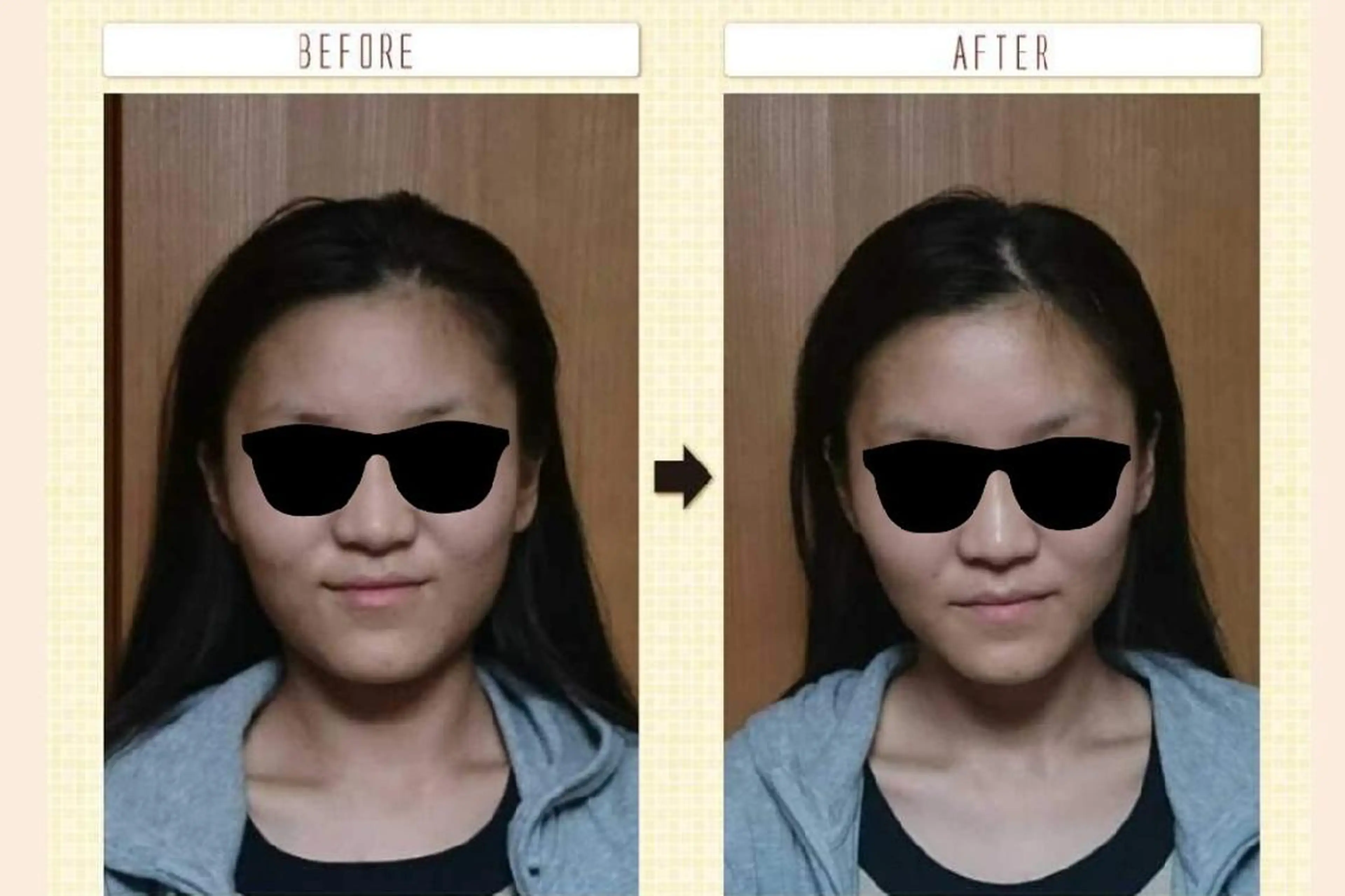 美顔ケアサロン ティアレのエステ・リラクイメージ