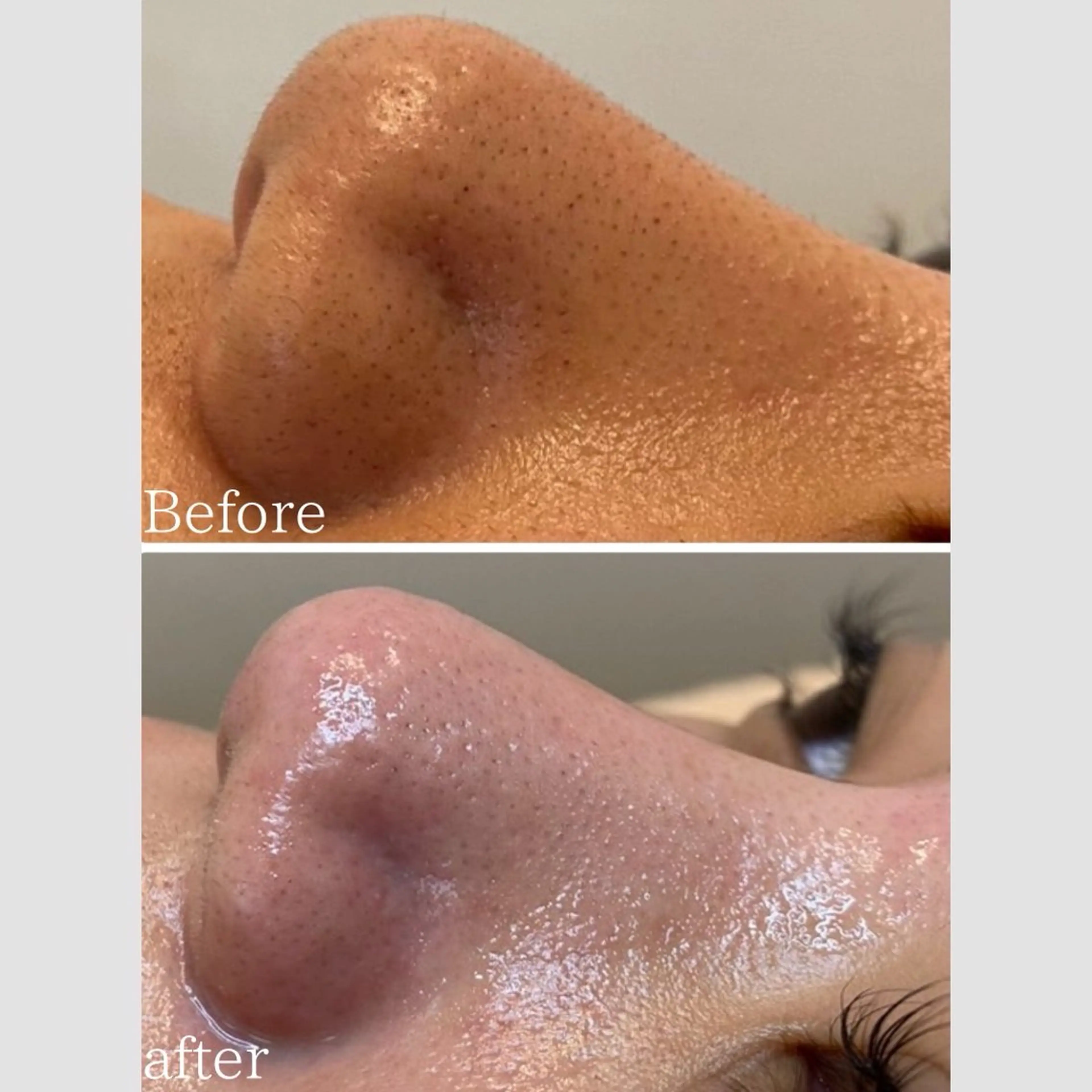 韓国肌管理 【毛穴専科】のエステ・リラクイメージ