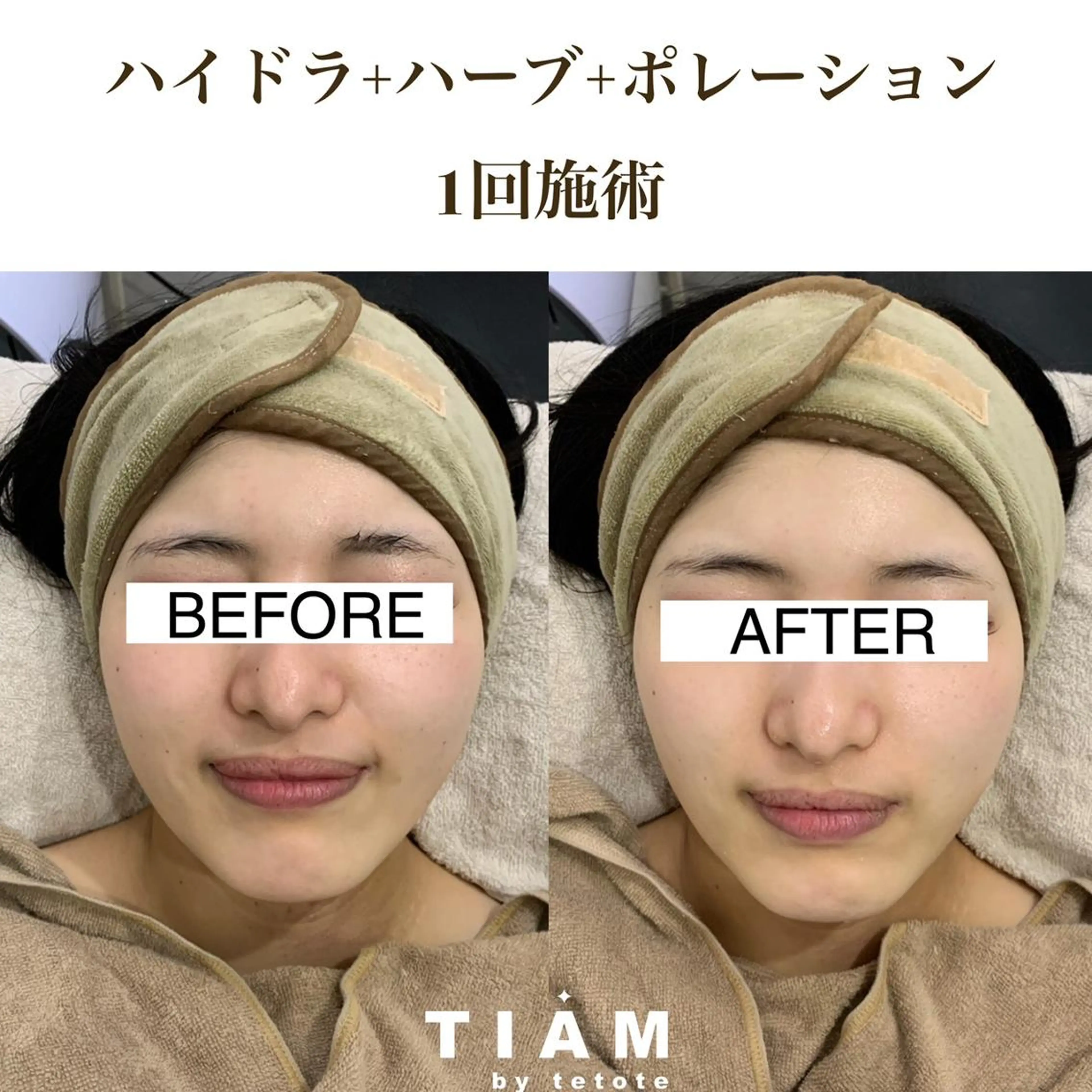 美肌サロンTIAM by tetoteのエステ・リラクイメージ