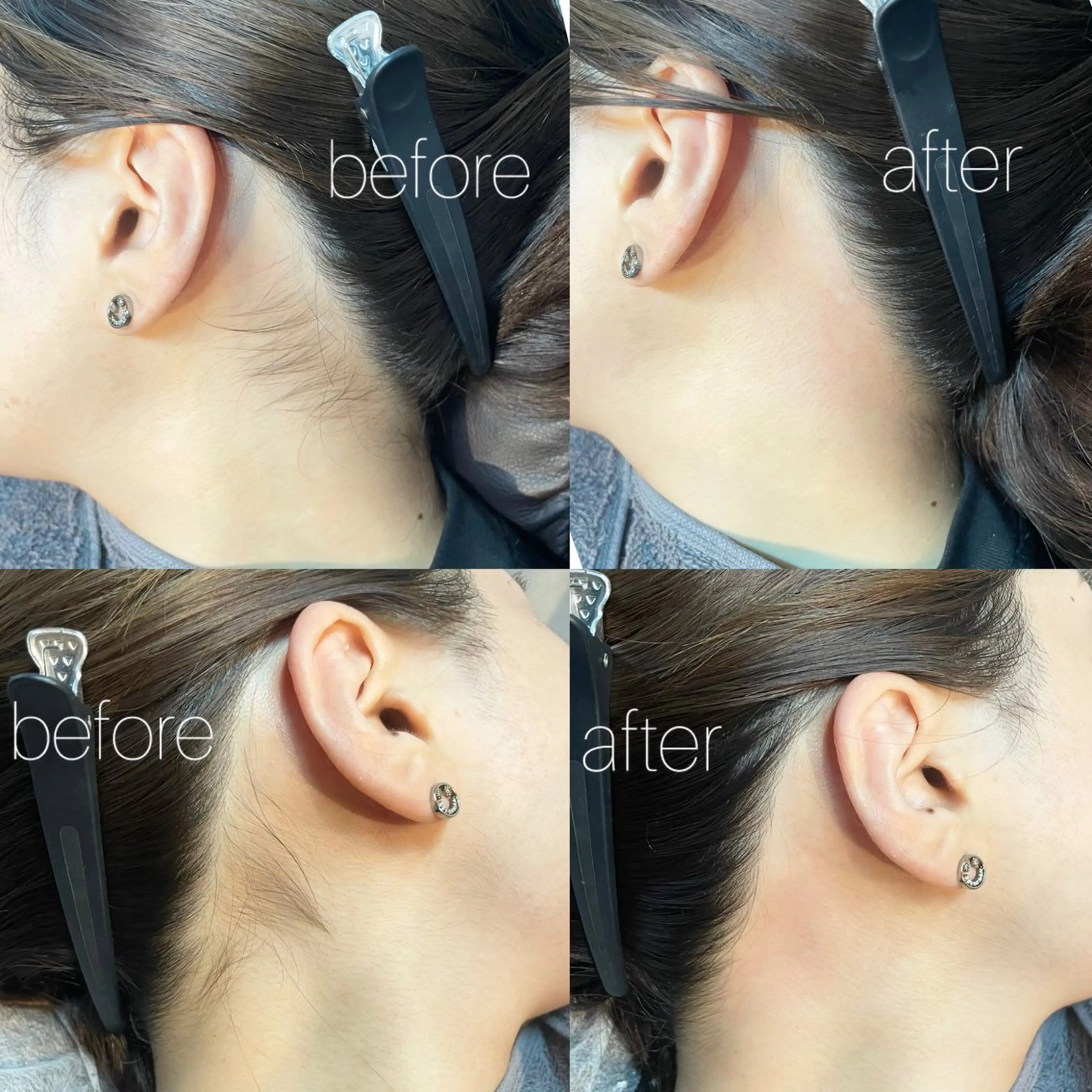 【SET MENU】FACE WAX＋うなじwax🫧の写真